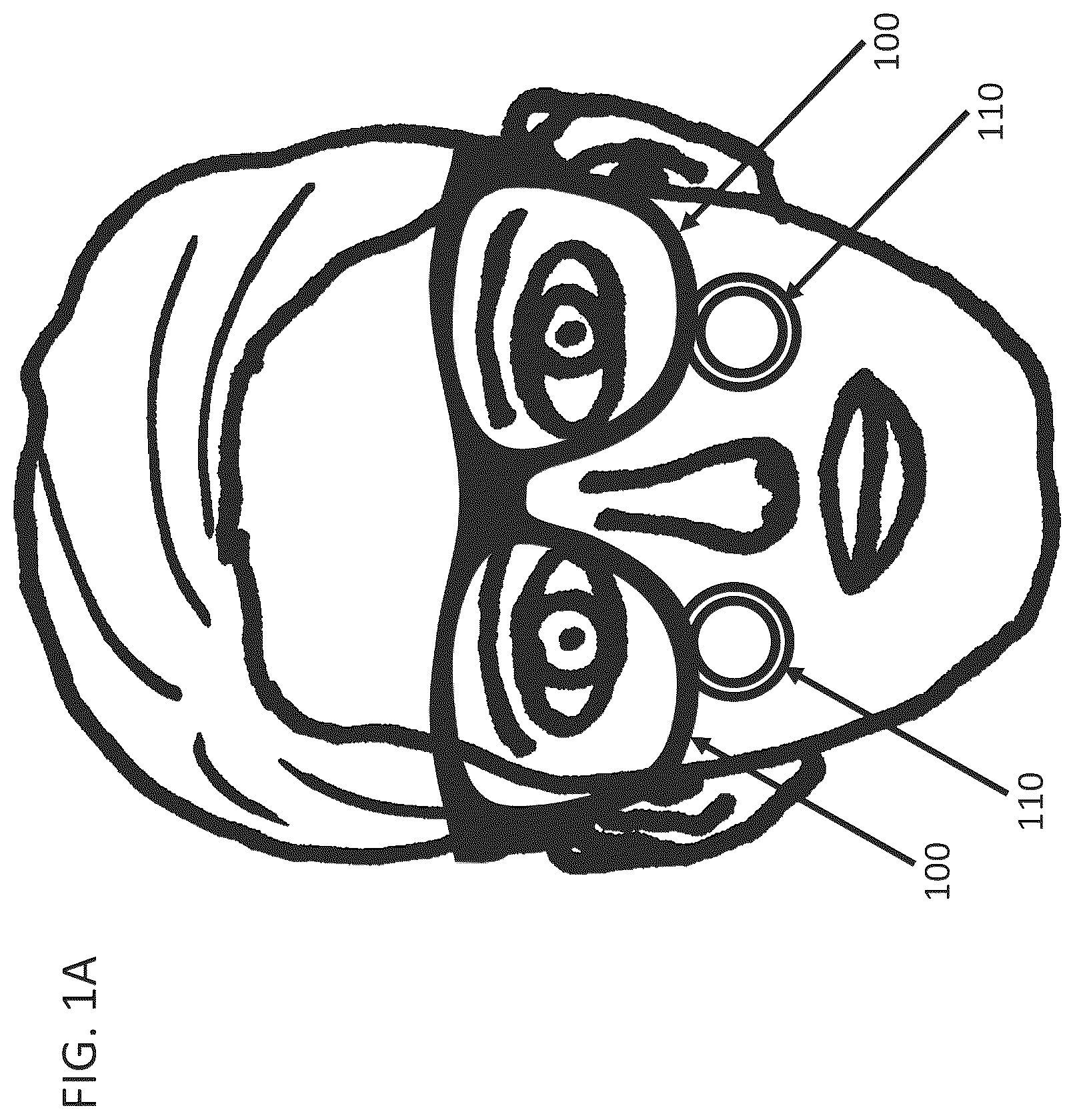 Patent US12366768 — Head mounted display assembly with control of head mounted display and loupe position and orientation — Figure 1