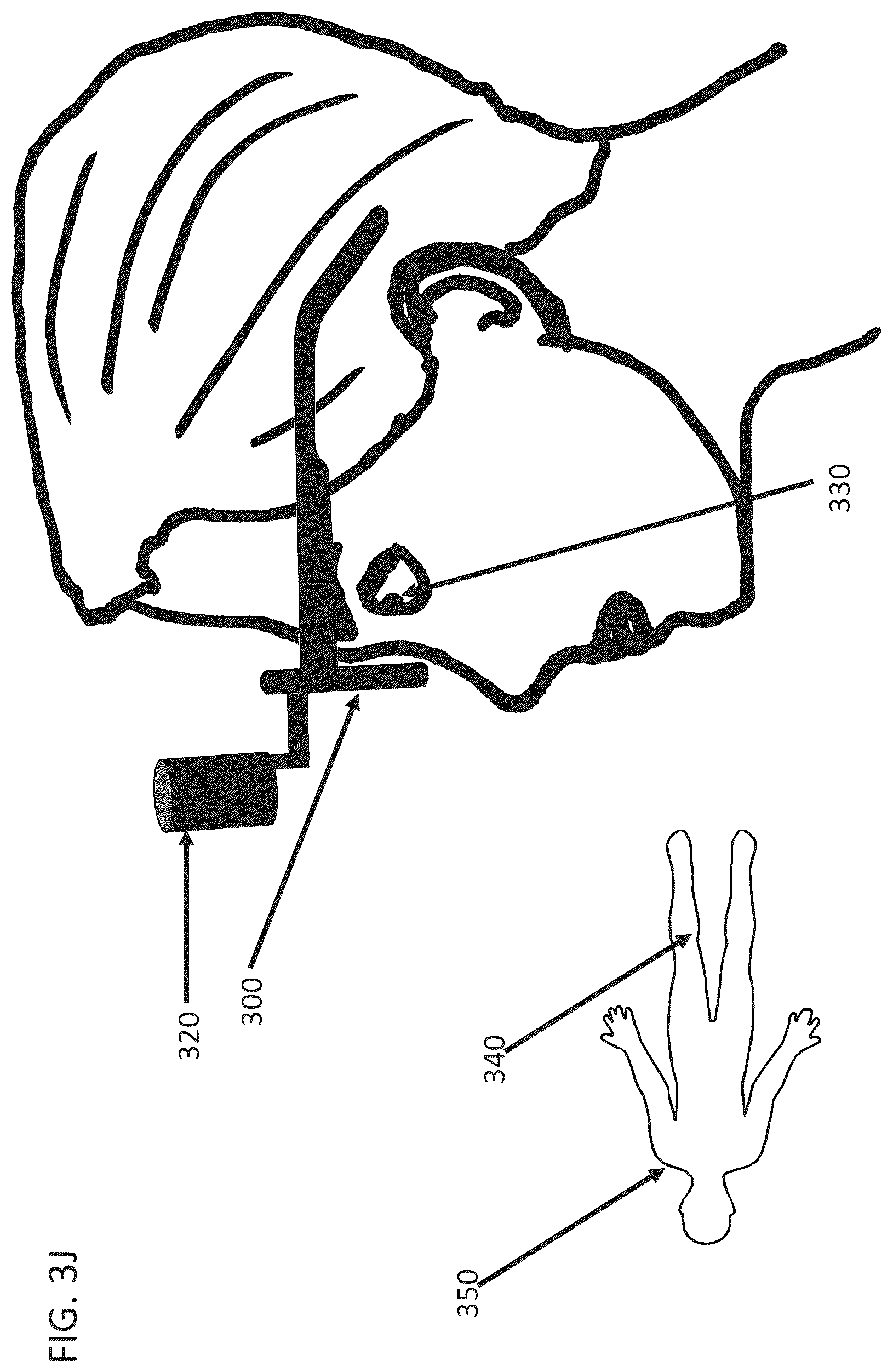 Patent US12366768 Figure 18 – Head mounted display assembly with control of head mounted display and loupe position and orientation