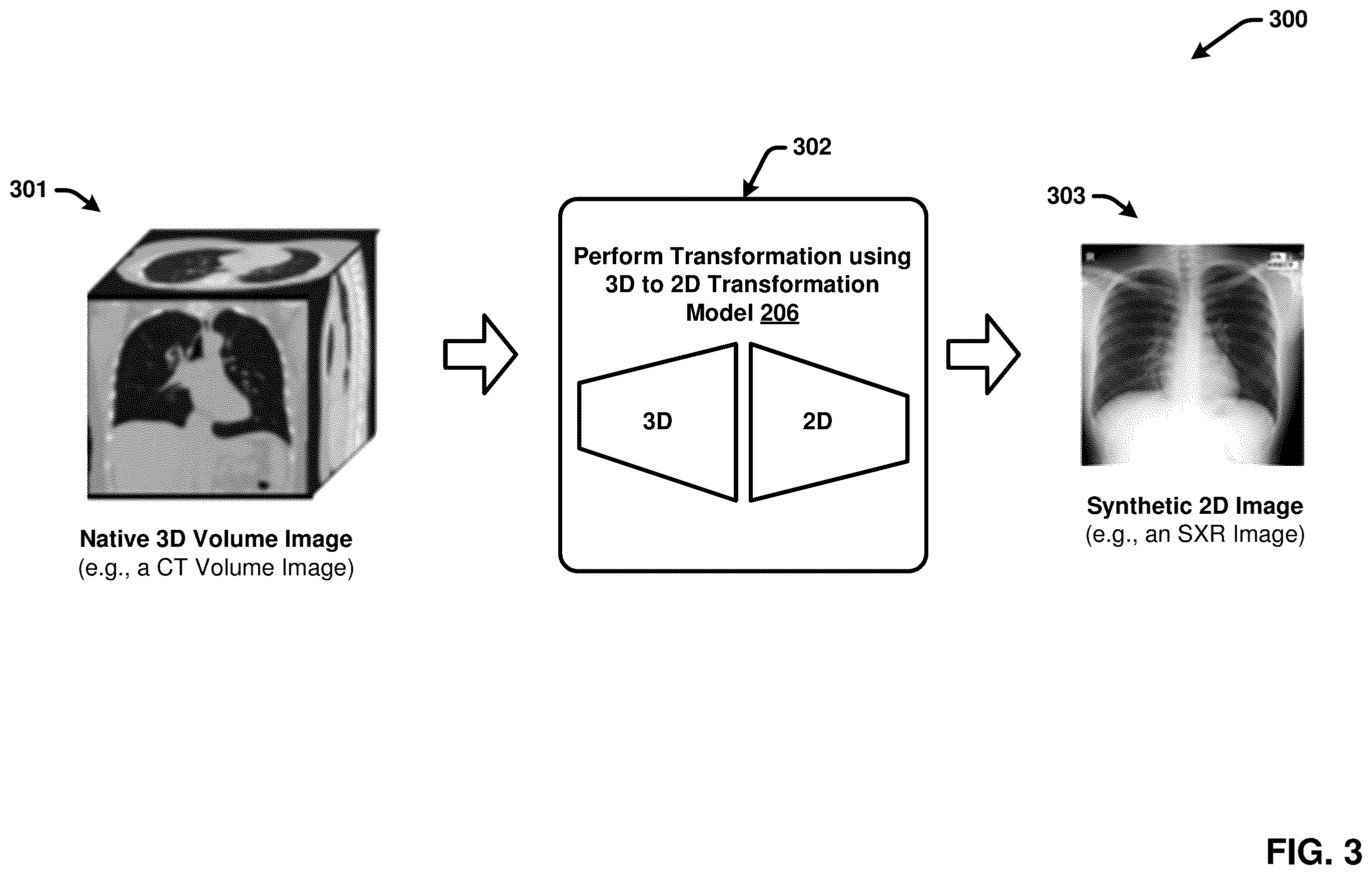Patent US12367260 Figure 3 – Multimodality image processing techniques for training image data generation and usage thereof for developing mono-modality image inferencing models