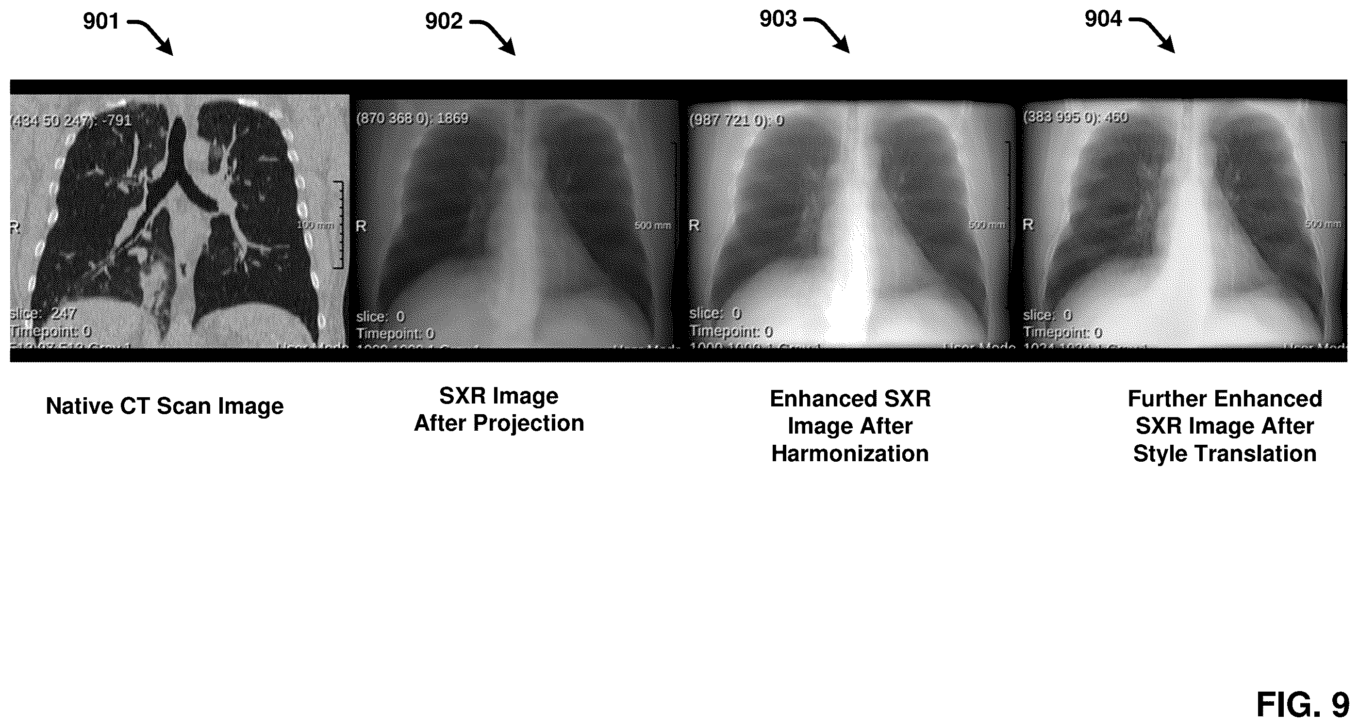 Patent US12367260 Figure 9 – Multimodality image processing techniques for training image data generation and usage thereof for developing mono-modality image inferencing models
