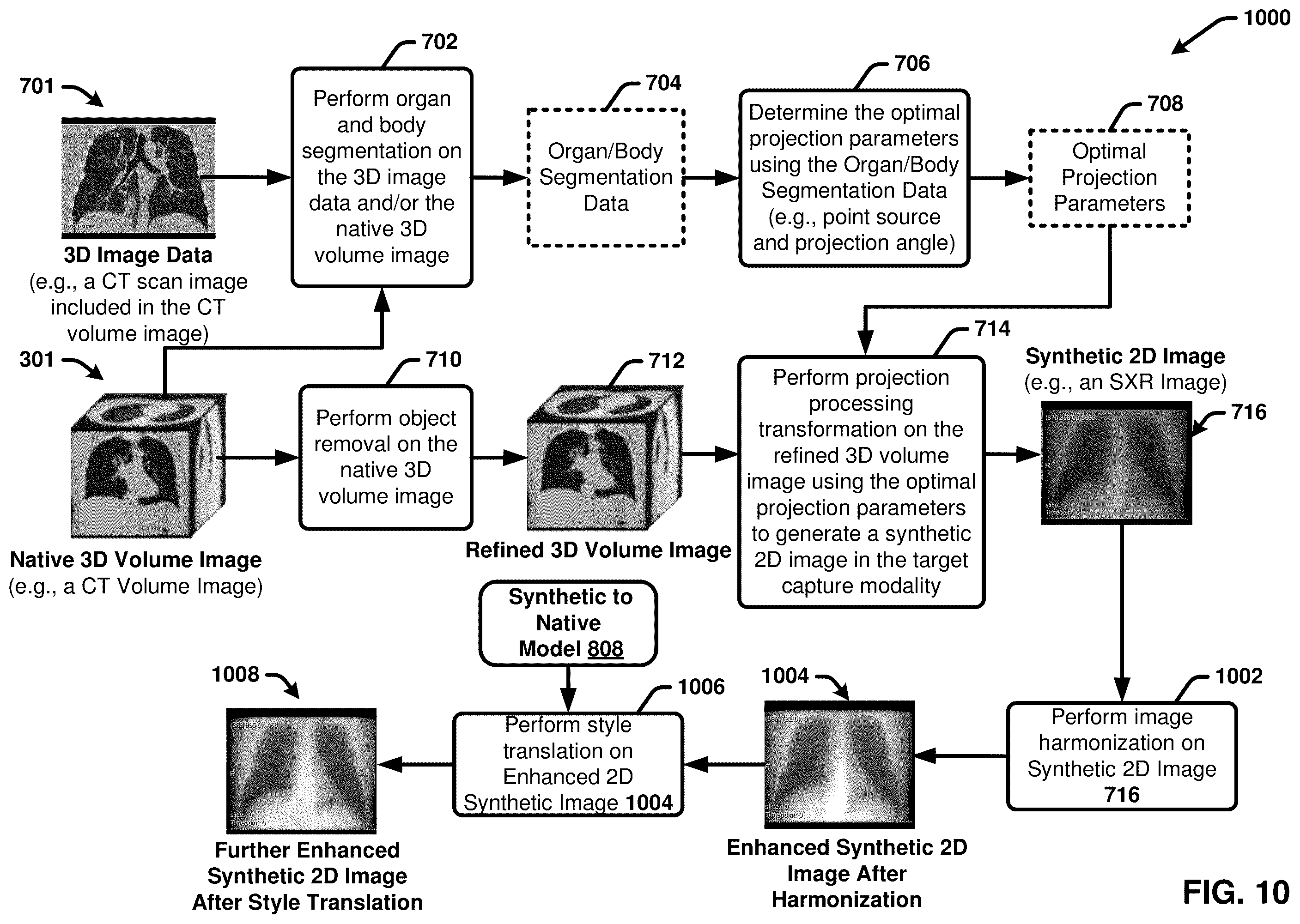 Patent US12367260 Figure 10 – Multimodality image processing techniques for training image data generation and usage thereof for developing mono-modality image inferencing models