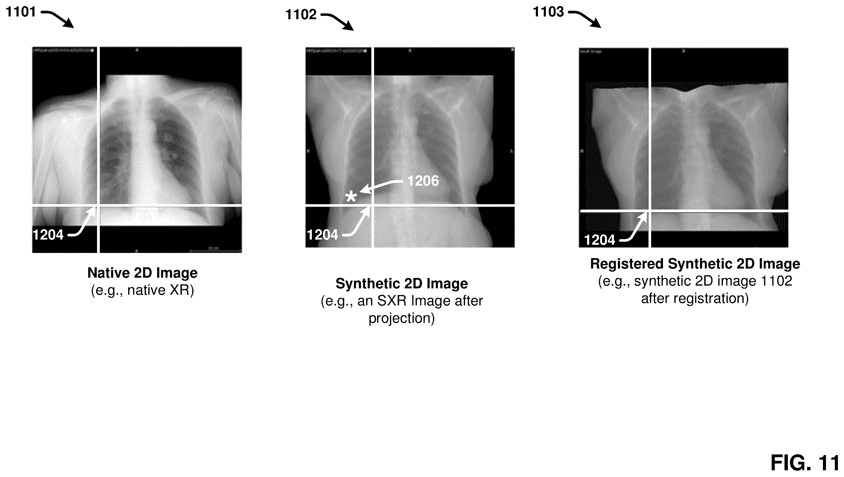 Patent US12367260 Figure 11 – Multimodality image processing techniques for training image data generation and usage thereof for developing mono-modality image inferencing models