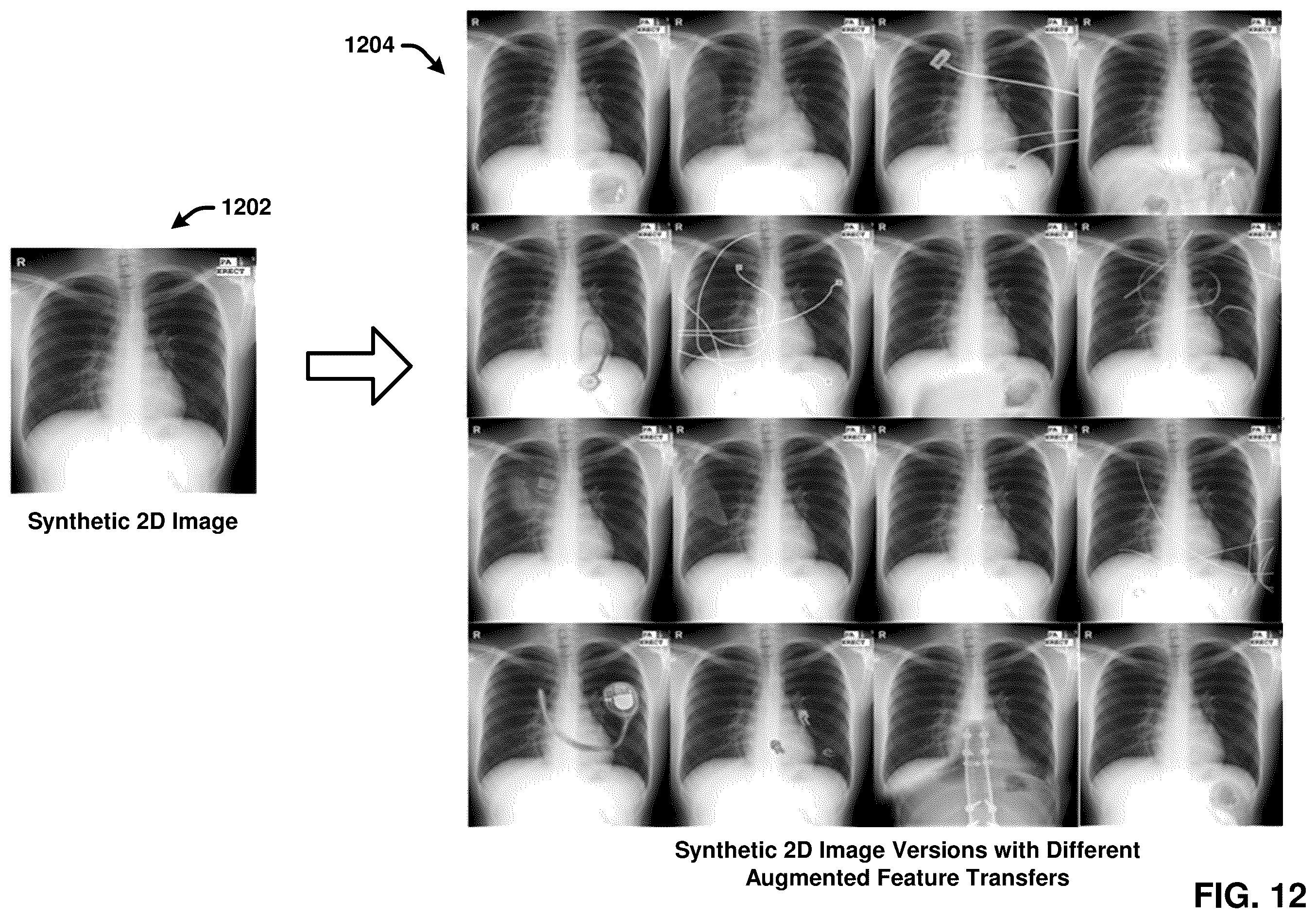 Patent US12367260 Figure 12 – Multimodality image processing techniques for training image data generation and usage thereof for developing mono-modality image inferencing models
