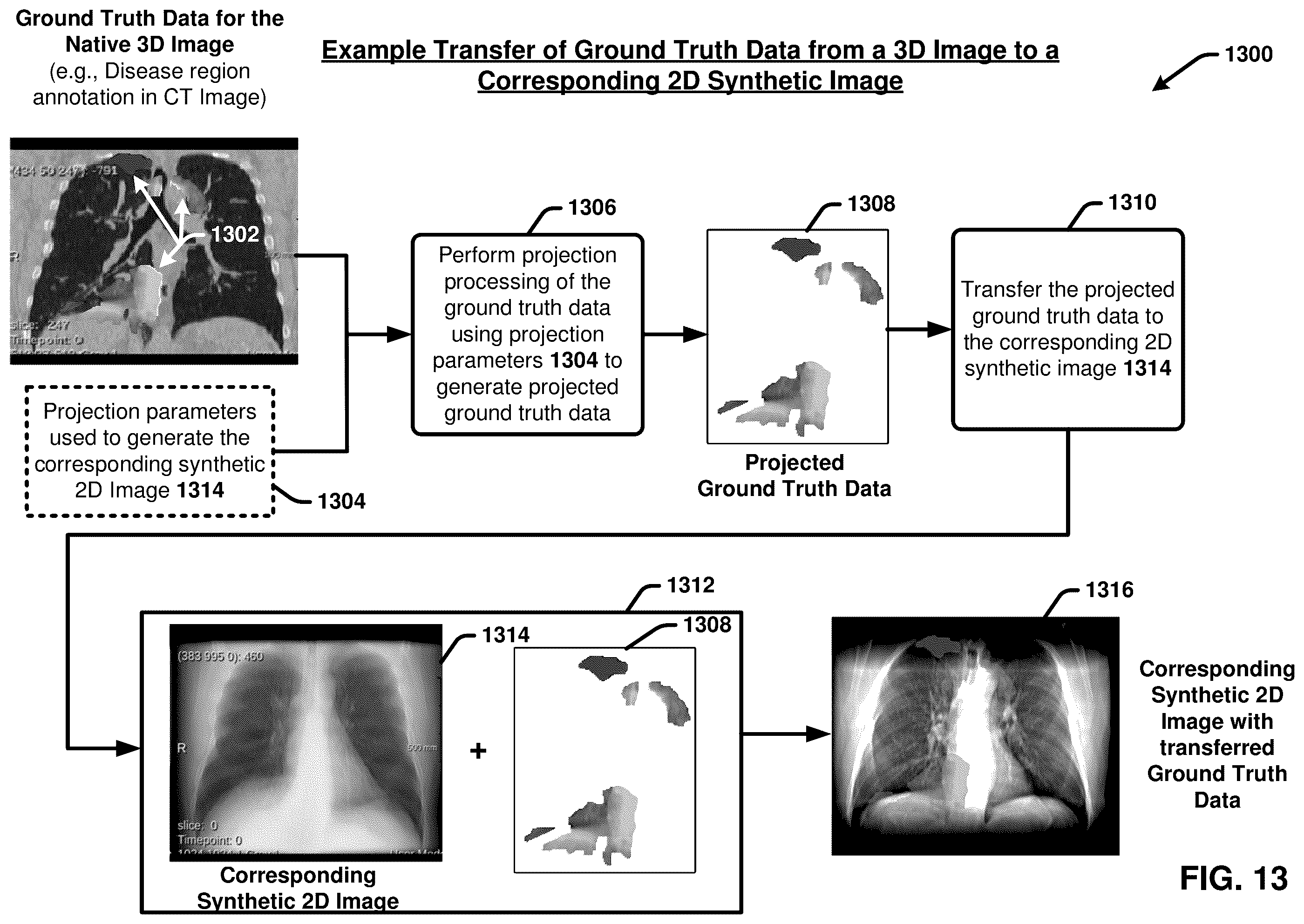 Patent US12367260 Figure 13 – Multimodality image processing techniques for training image data generation and usage thereof for developing mono-modality image inferencing models