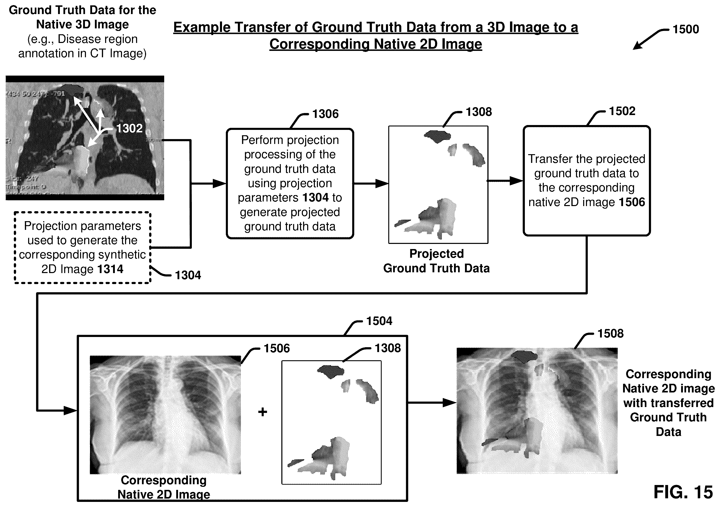 Patent US12367260 Figure 15 – Multimodality image processing techniques for training image data generation and usage thereof for developing mono-modality image inferencing models