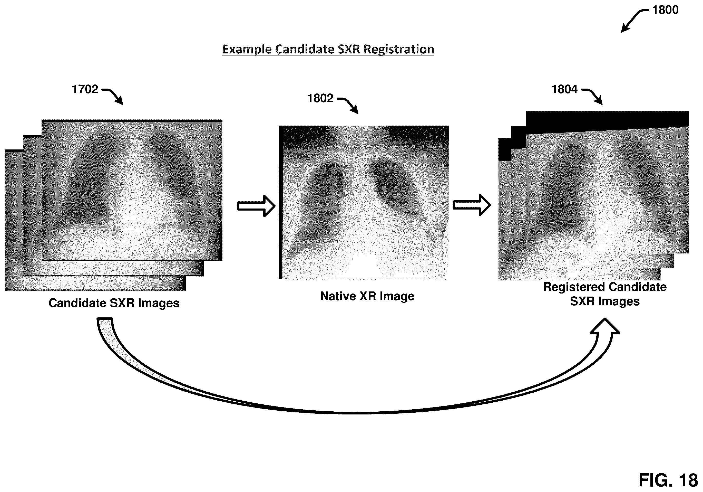 Patent US12367260 Figure 18 – Multimodality image processing techniques for training image data generation and usage thereof for developing mono-modality image inferencing models