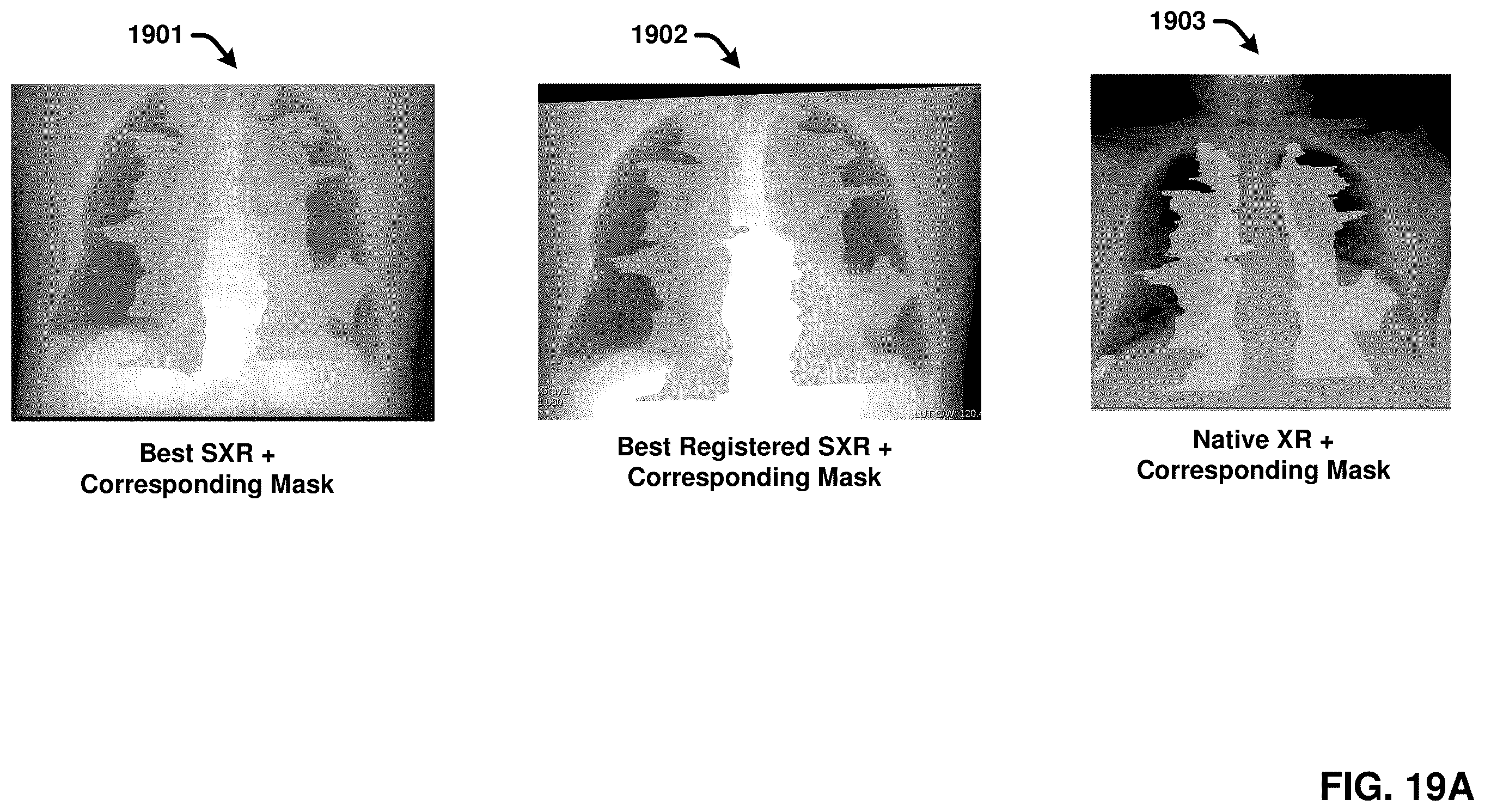 Patent US12367260 Figure 19 – Multimodality image processing techniques for training image data generation and usage thereof for developing mono-modality image inferencing models