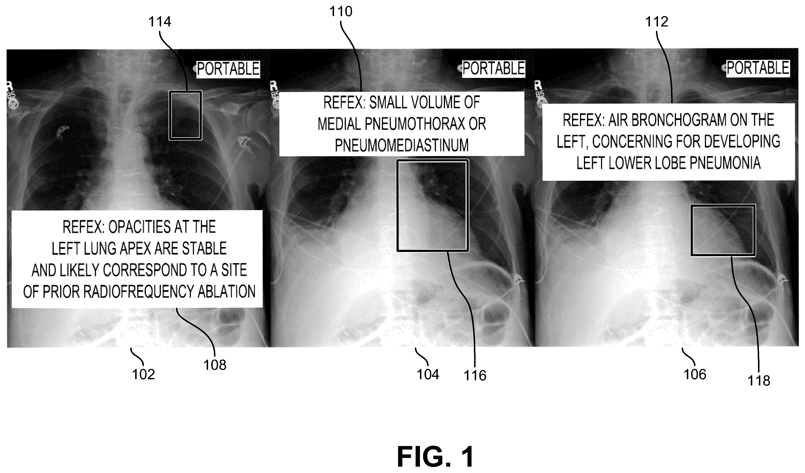 Patent US12367261 — Extending supervision using machine learning — Figure 1