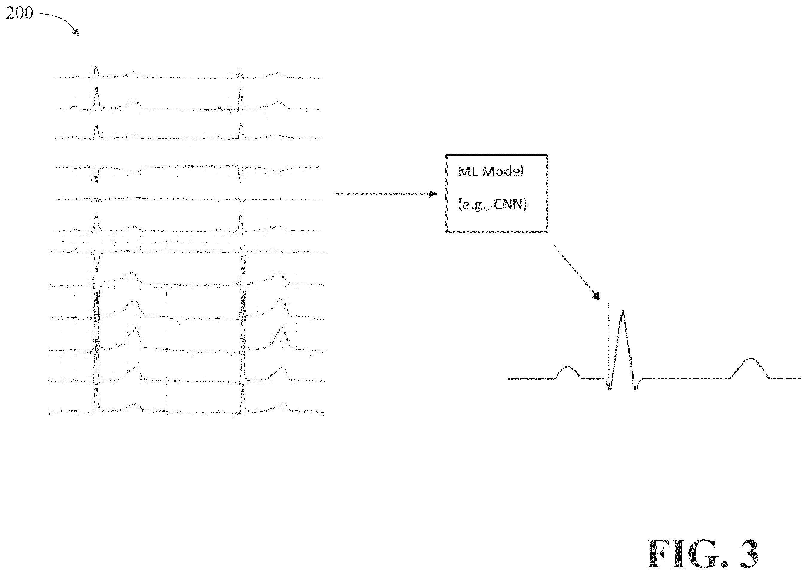 Patent US12367392 Figure 4 – Apparatus (and/or method) of training a machine-learning model to generate determinations using mismatched-channel signals
