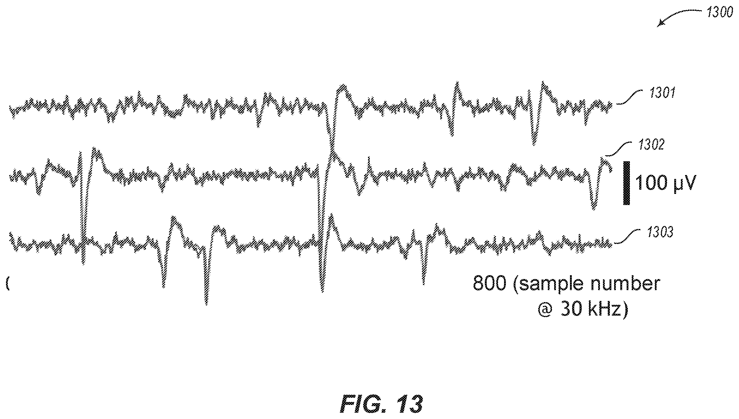 Patent US12367557 Figure 13 – Removing independent noise using DeepInterpolation