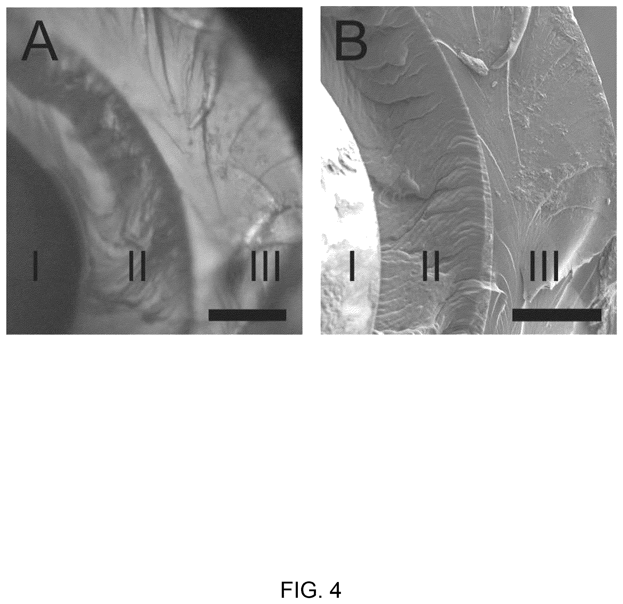 Patent US12367563 Figure 4 – Tomographic reconstruction apparatus and removing diffraction effects in a tomographic image