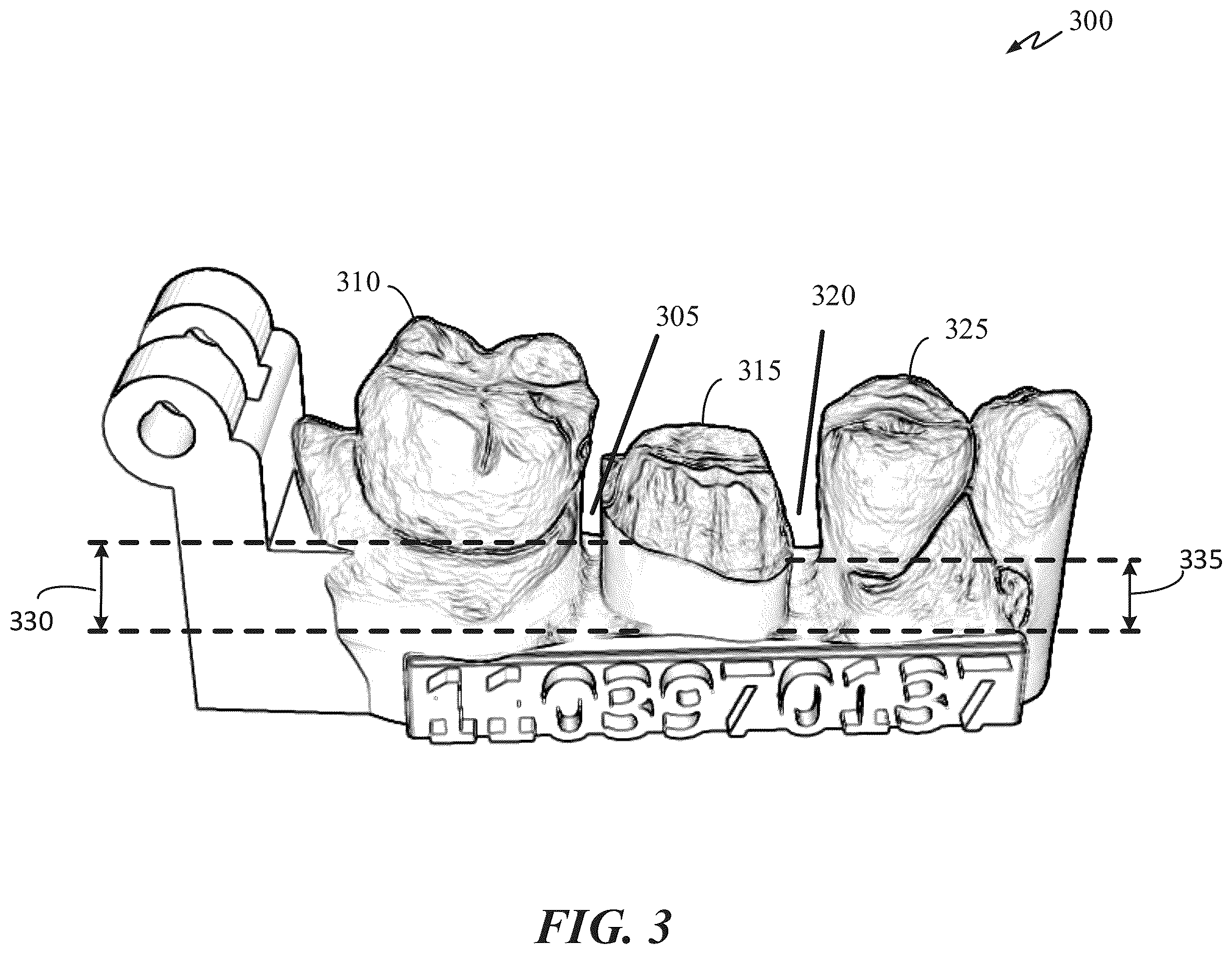 Patent US12367568 Figure 4 – System and method for performing quality control of manufactured models