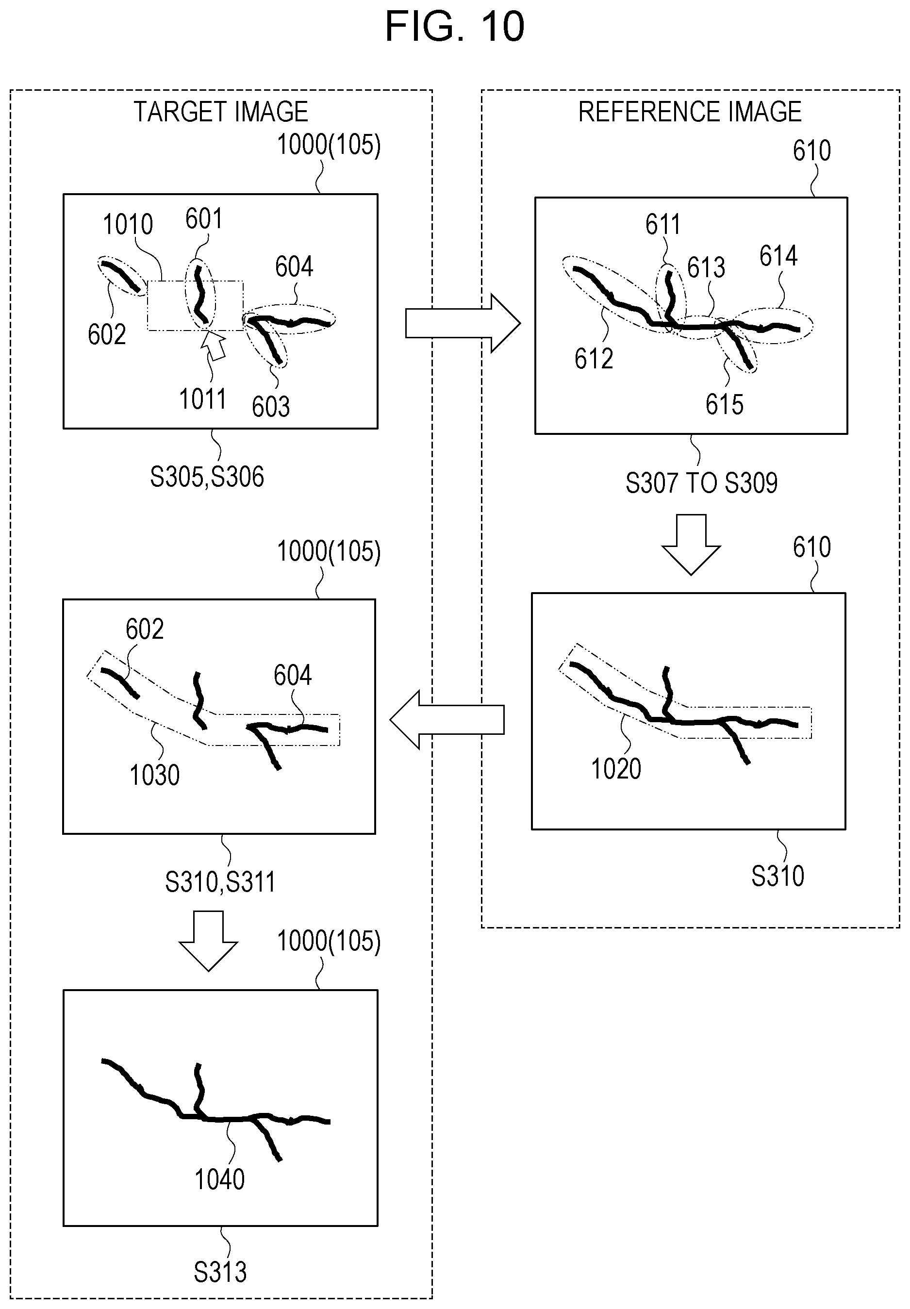 Patent US12367573 Figure 10 – Image processing apparatus, image processing method, and program for detecting defect from image