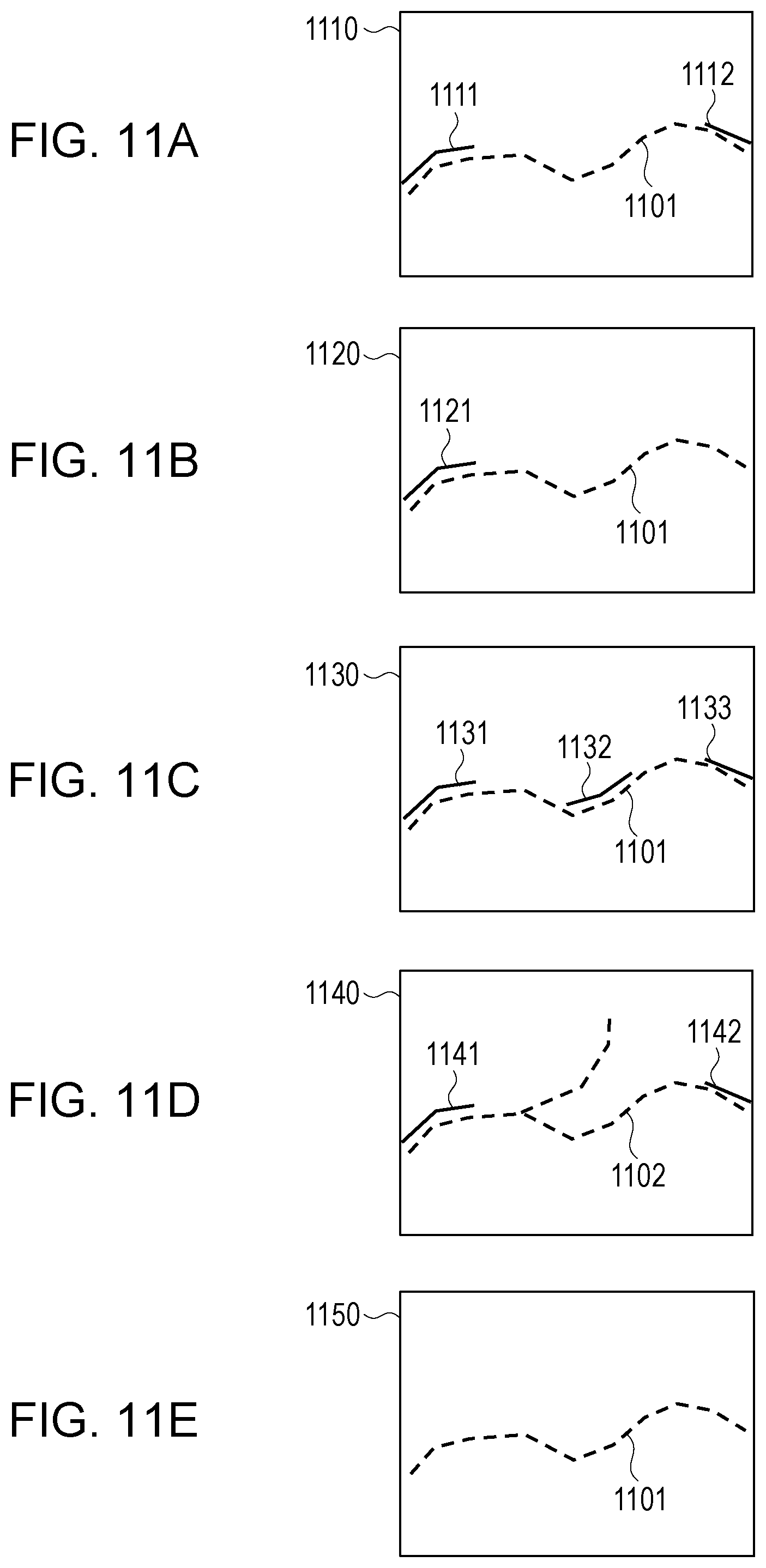 Patent US12367573 Figure 11 – Image processing apparatus, image processing method, and program for detecting defect from image