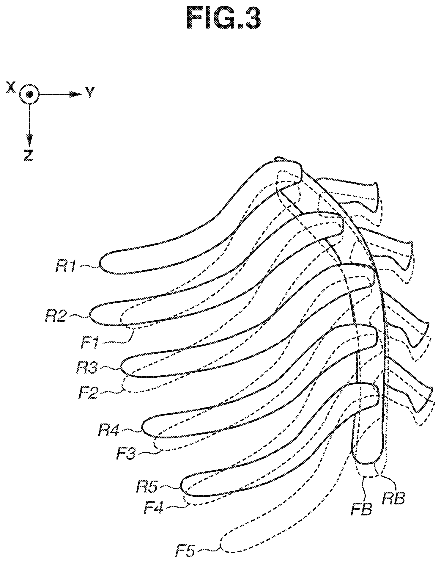 Patent US12367575 Figure 3 – Image processing apparatus, image processing method, and non-transitory storage medium