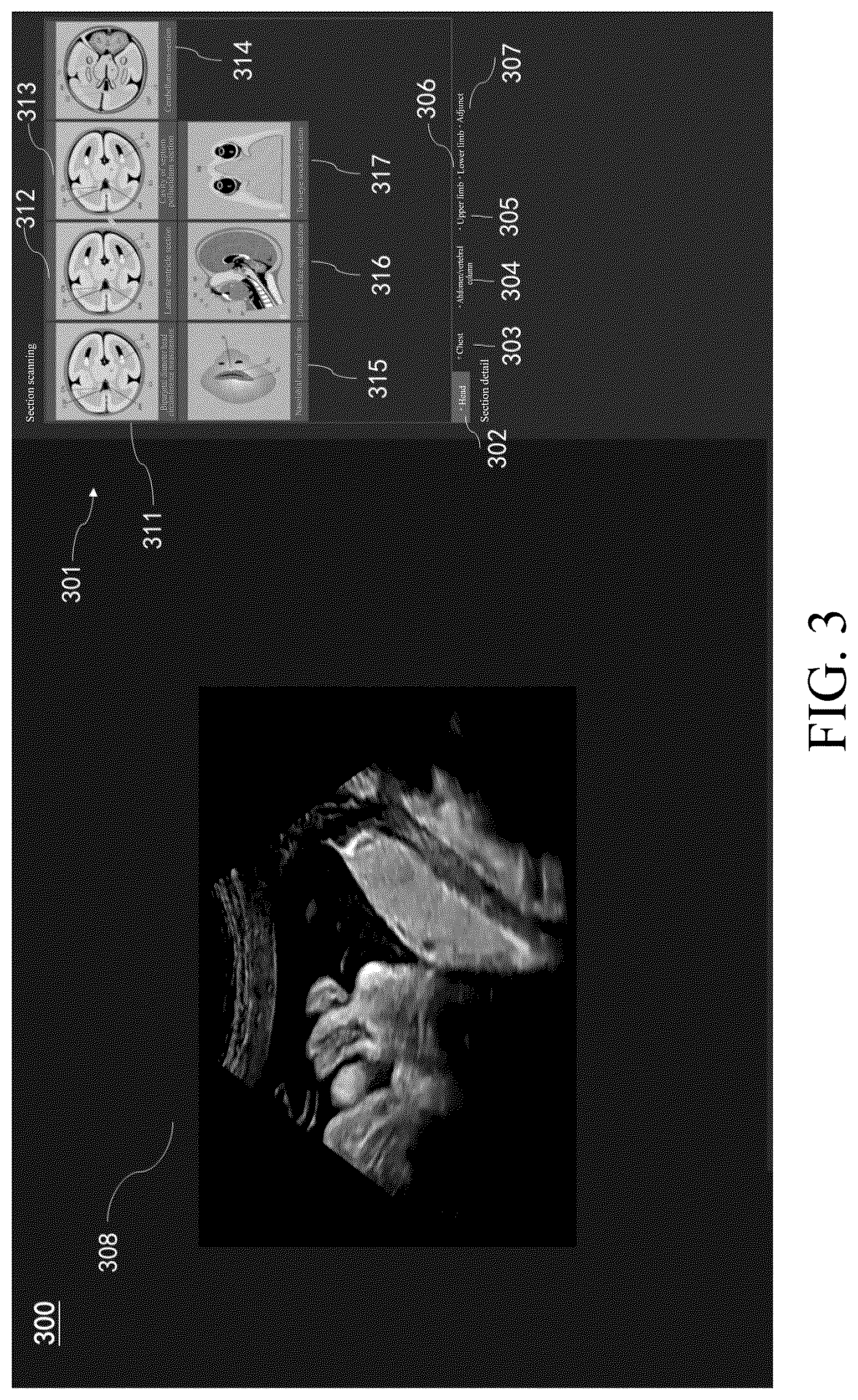Patent US12367576 Figure 3 – Ultrasonic imaging method, ultrasonic imaging system, and non-transitory computer-readable medium