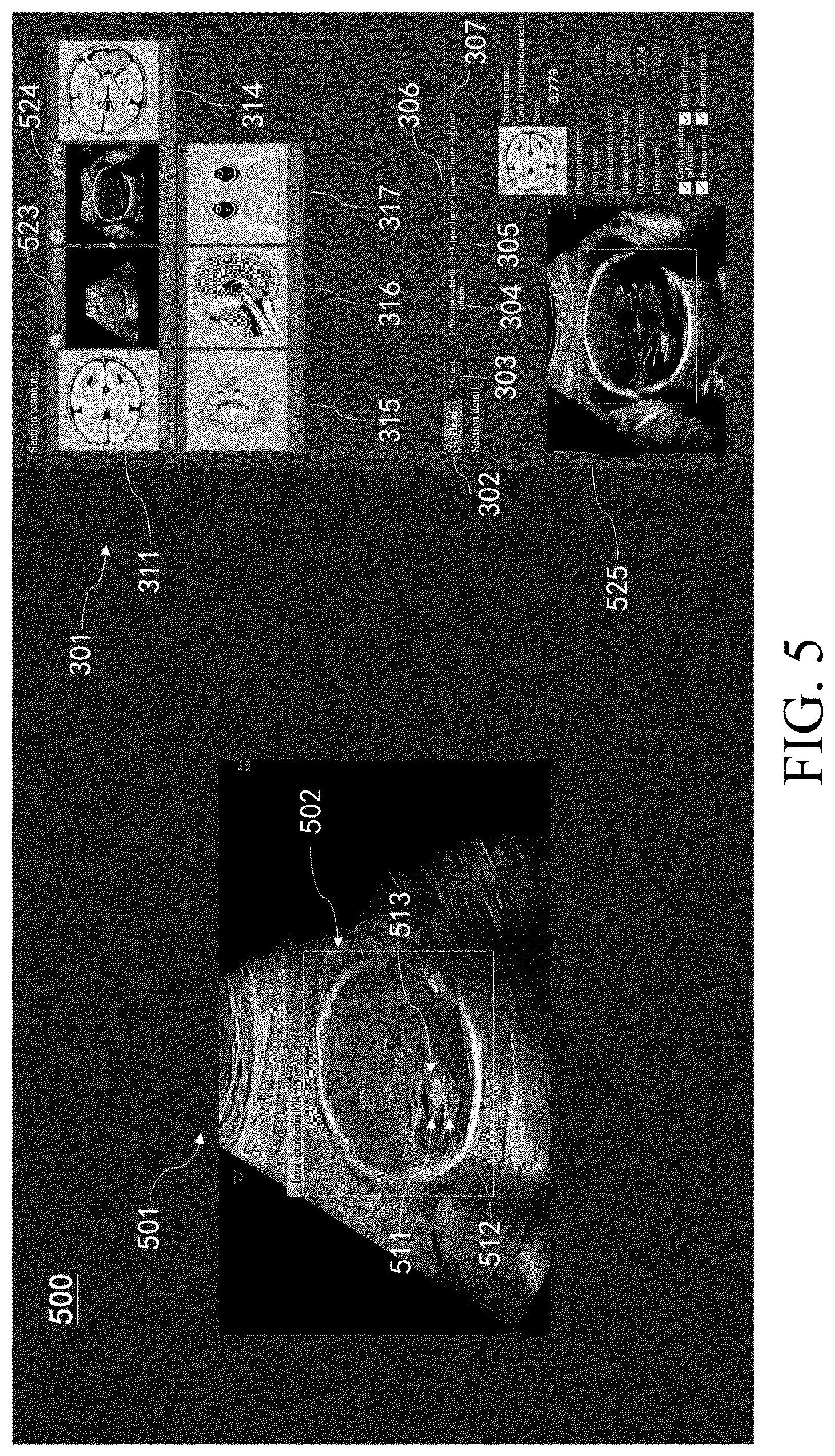 Patent US12367576 Figure 5 – Ultrasonic imaging method, ultrasonic imaging system, and non-transitory computer-readable medium