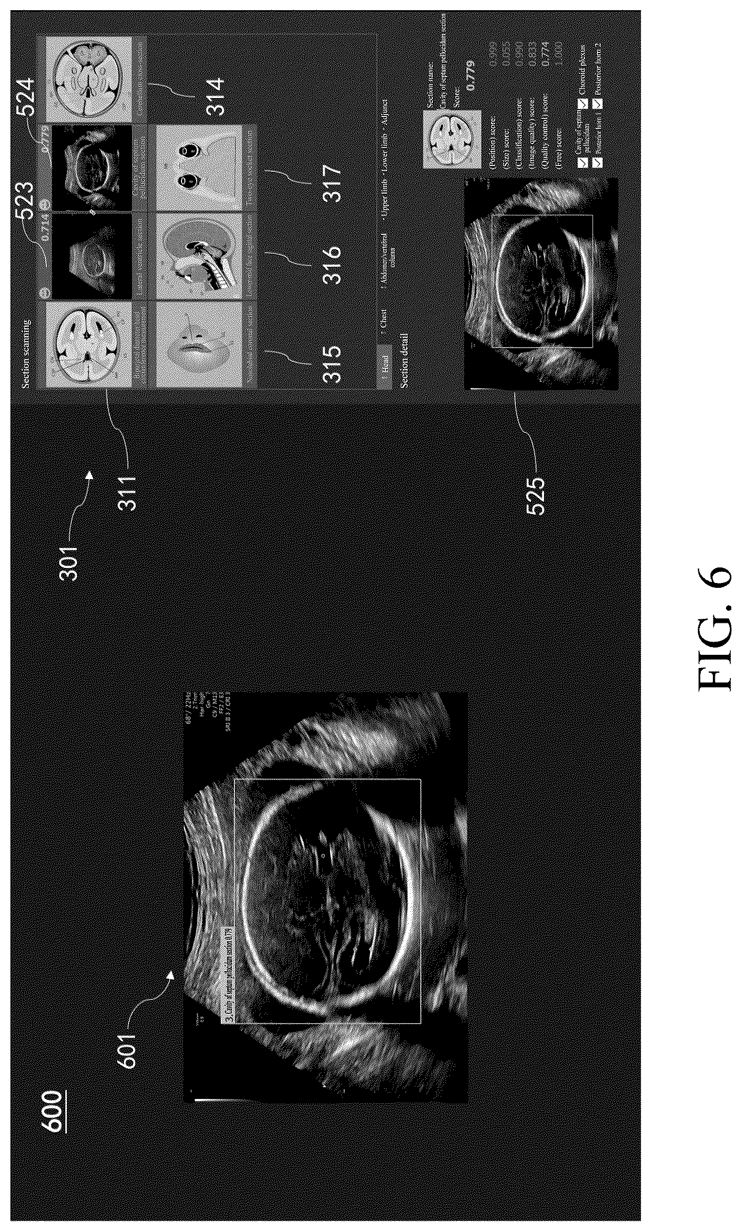 Patent US12367576 Figure 6 – Ultrasonic imaging method, ultrasonic imaging system, and non-transitory computer-readable medium
