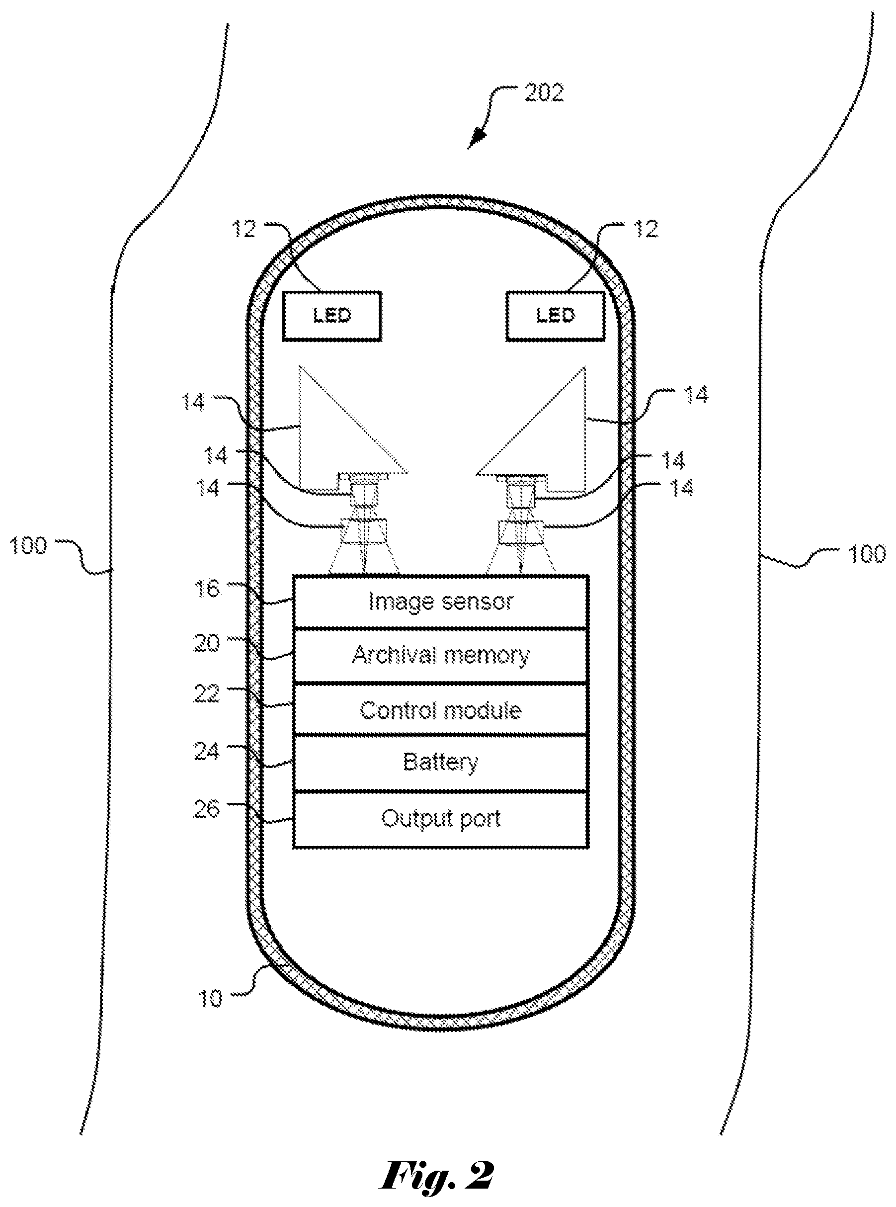 Patent US12367577 Figure 2 – System and method for reviewing capsule images with detected regions of interest