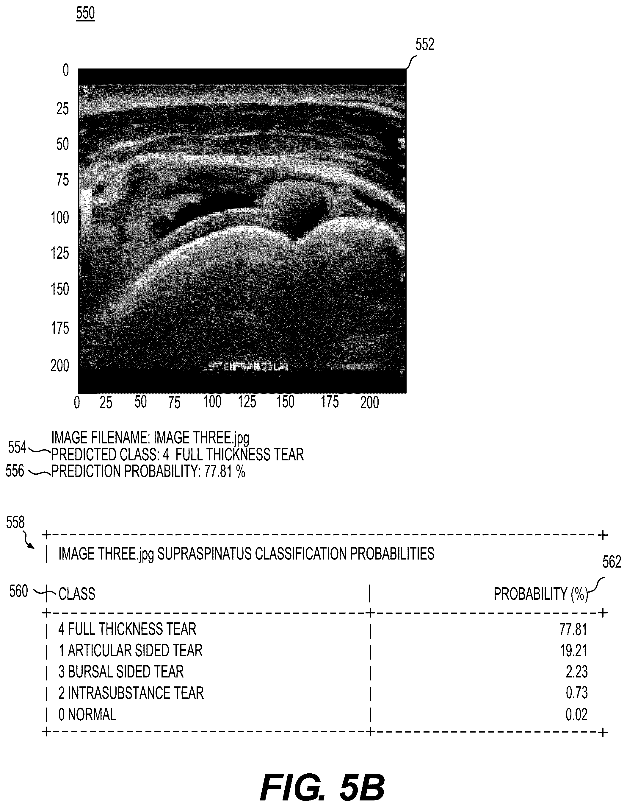 Patent US12367579 Figure 5 – Systems and methods to process electronic medical images for diagnostic or interventional use