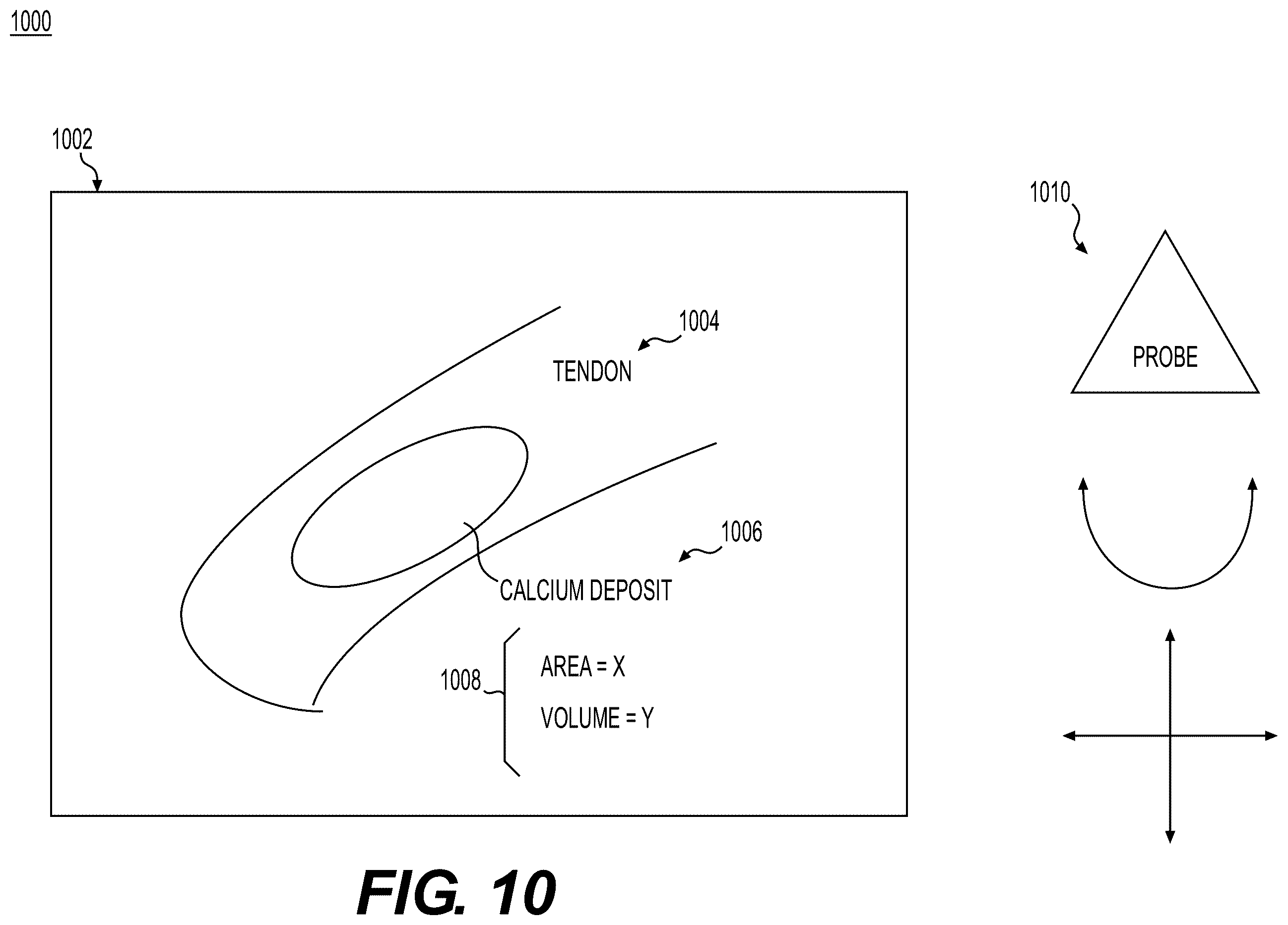 Patent US12367579 Figure 8 – Systems and methods to process electronic medical images for diagnostic or interventional use