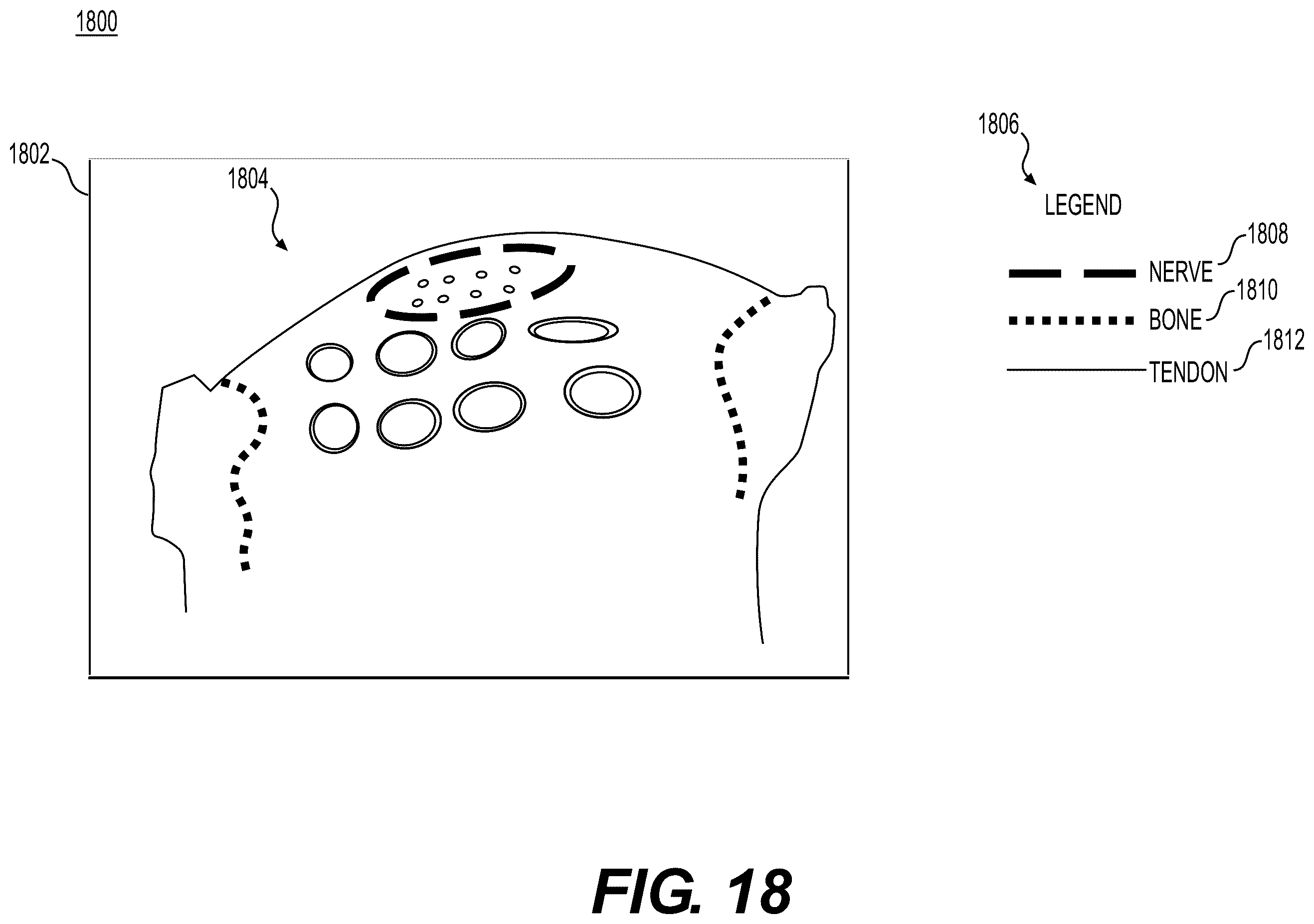 Patent US12367579 Figure 13 – Systems and methods to process electronic medical images for diagnostic or interventional use