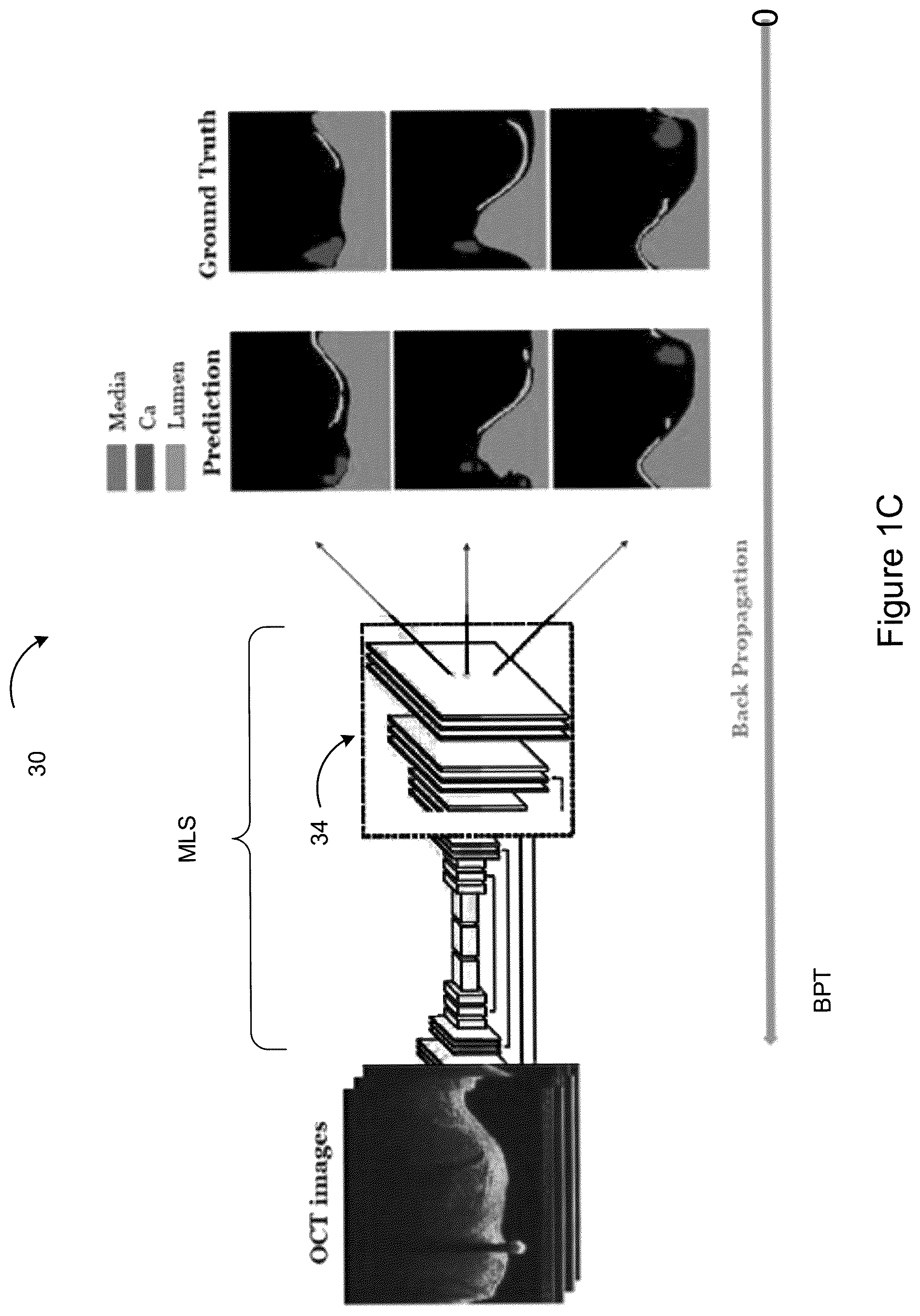 Patent US12367588 Figure 3 – Systems and methods for classification of arterial image regions and features thereof