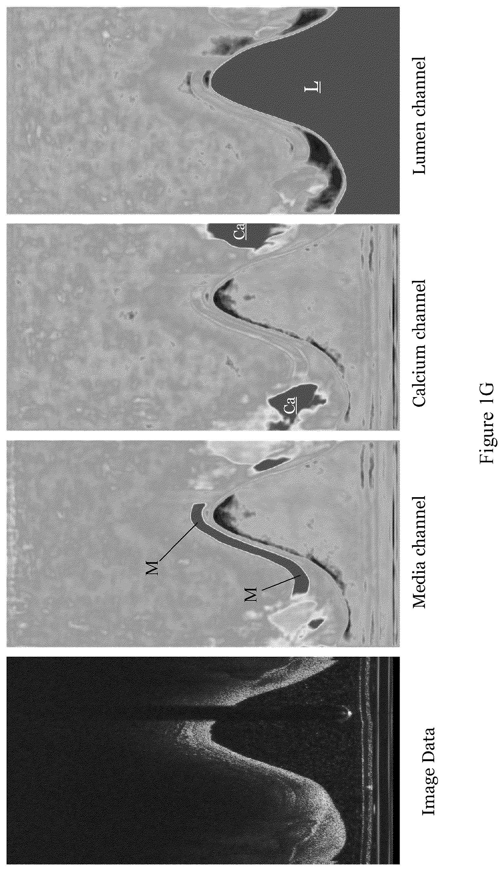 Patent US12367588 Figure 6 – Systems and methods for classification of arterial image regions and features thereof