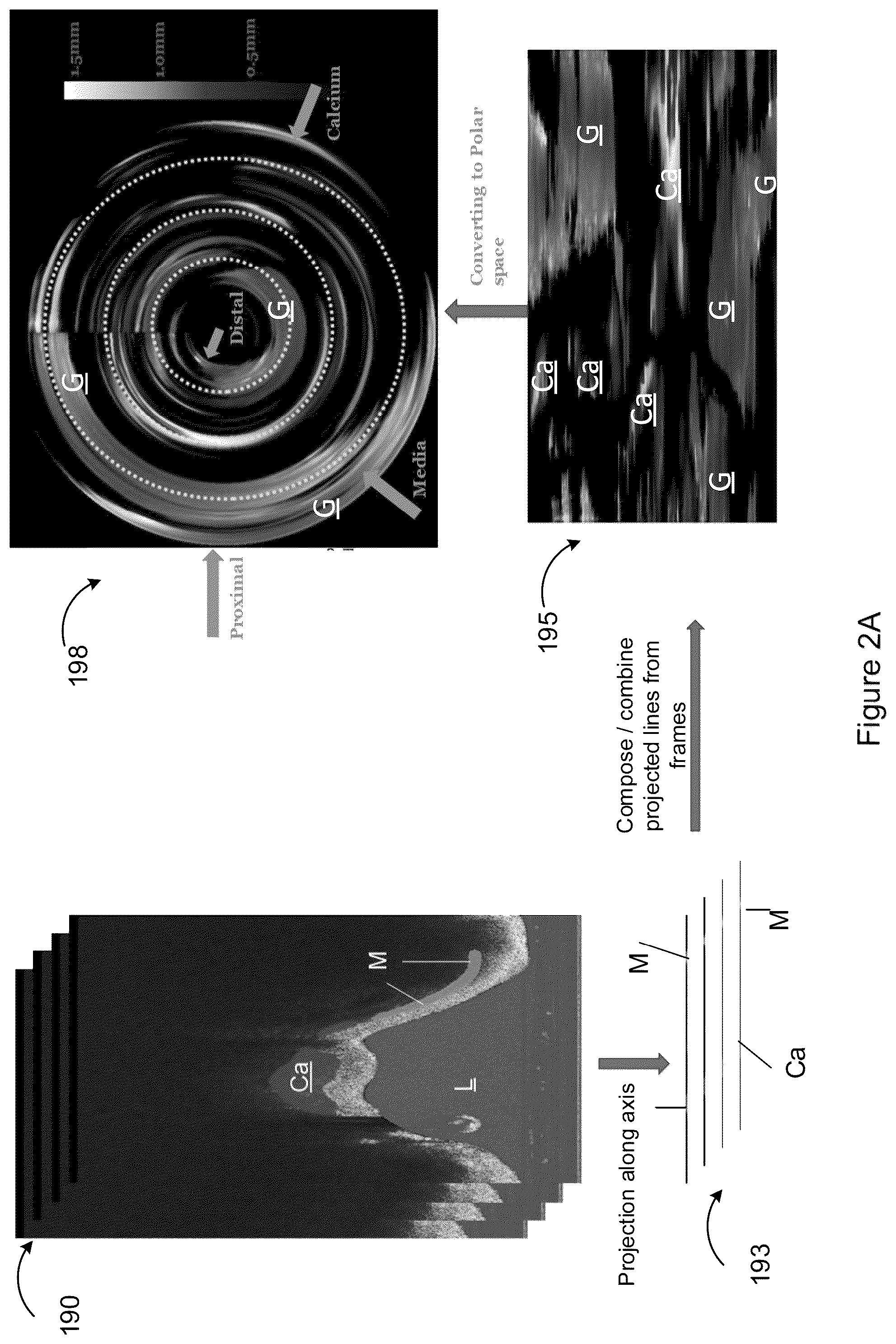 Patent US12367588 Figure 8 – Systems and methods for classification of arterial image regions and features thereof