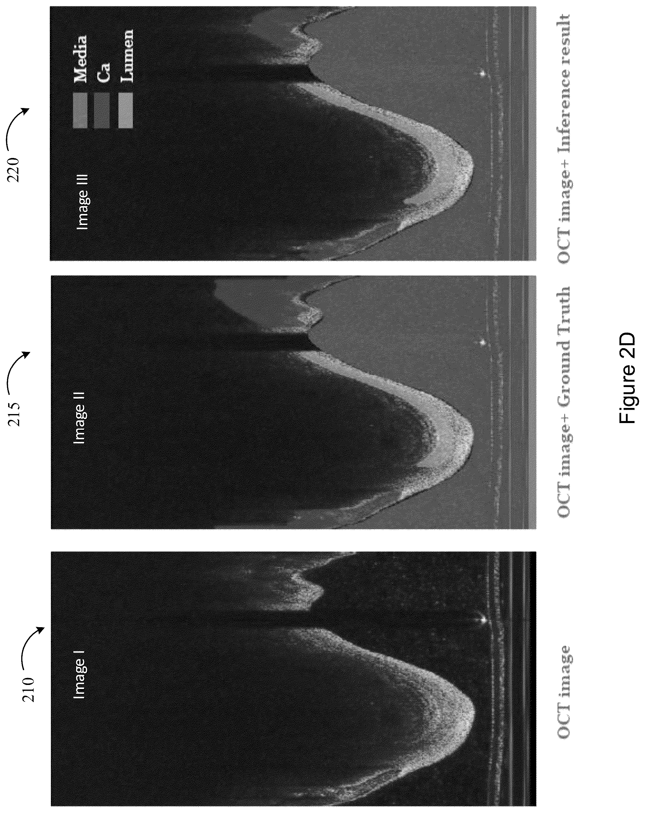 Patent US12367588 Figure 10 – Systems and methods for classification of arterial image regions and features thereof