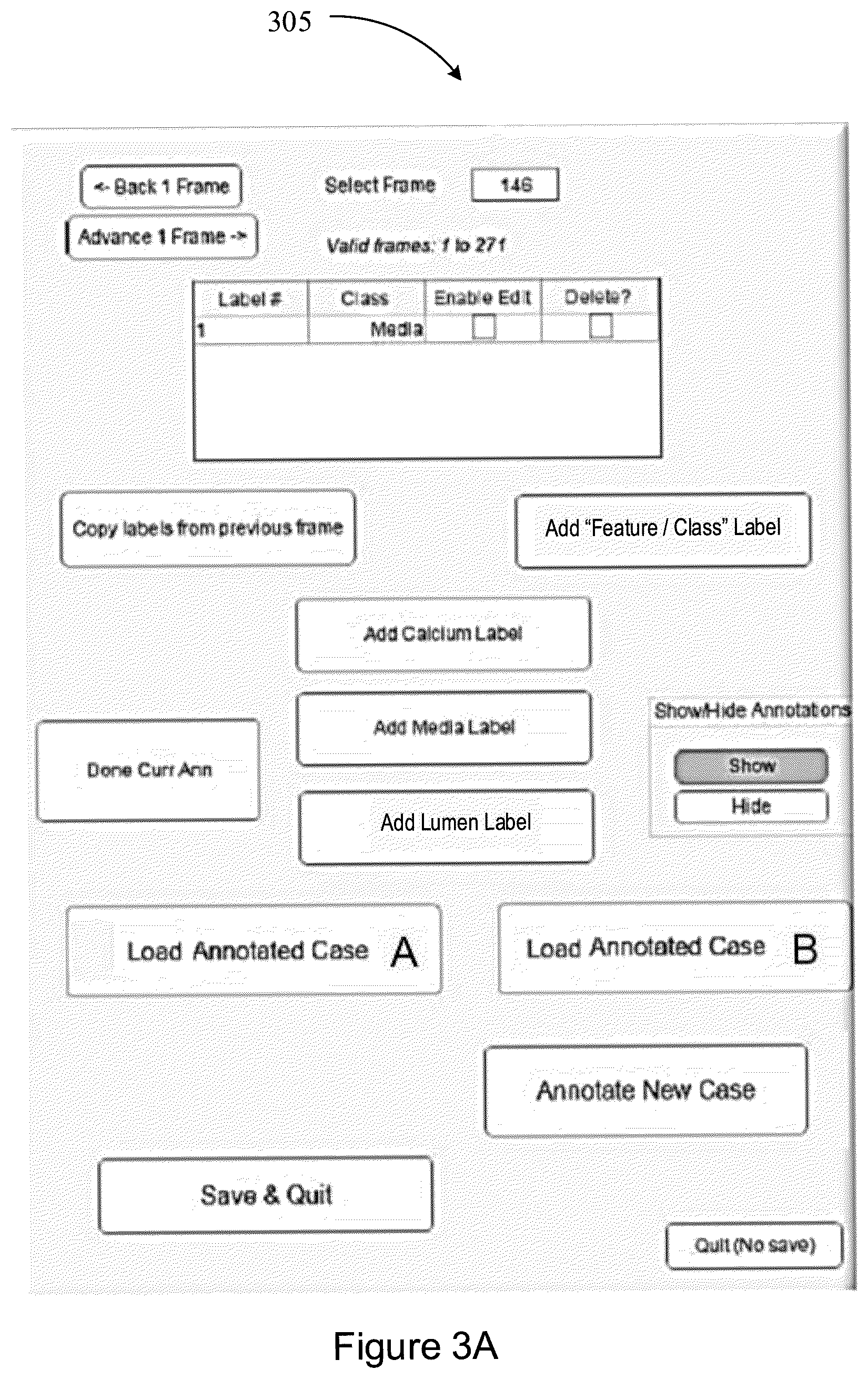 Patent US12367588 Figure 12 – Systems and methods for classification of arterial image regions and features thereof
