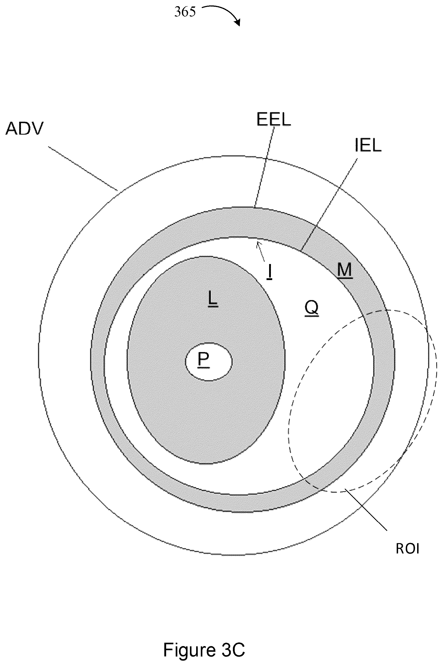 Patent US12367588 Figure 14 – Systems and methods for classification of arterial image regions and features thereof