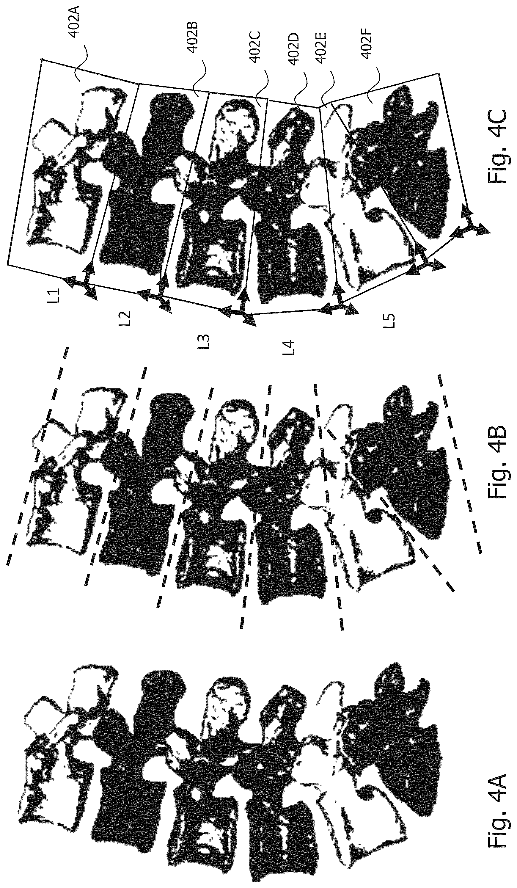 Patent US12367598 Figure 4 – Technique of generating surgical information from intra-operatively and pre-operatively acquired image data