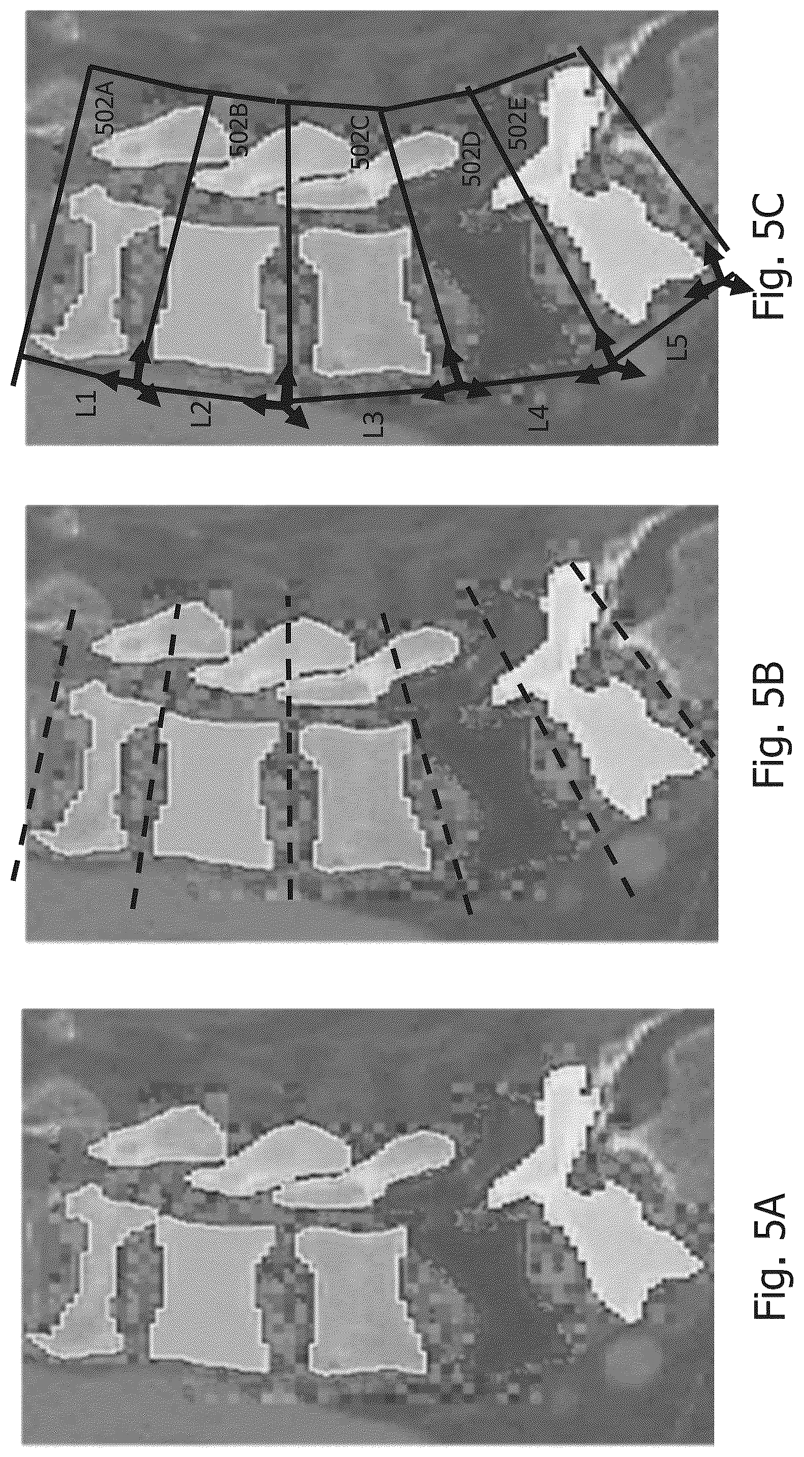Patent US12367598 Figure 5 – Technique of generating surgical information from intra-operatively and pre-operatively acquired image data