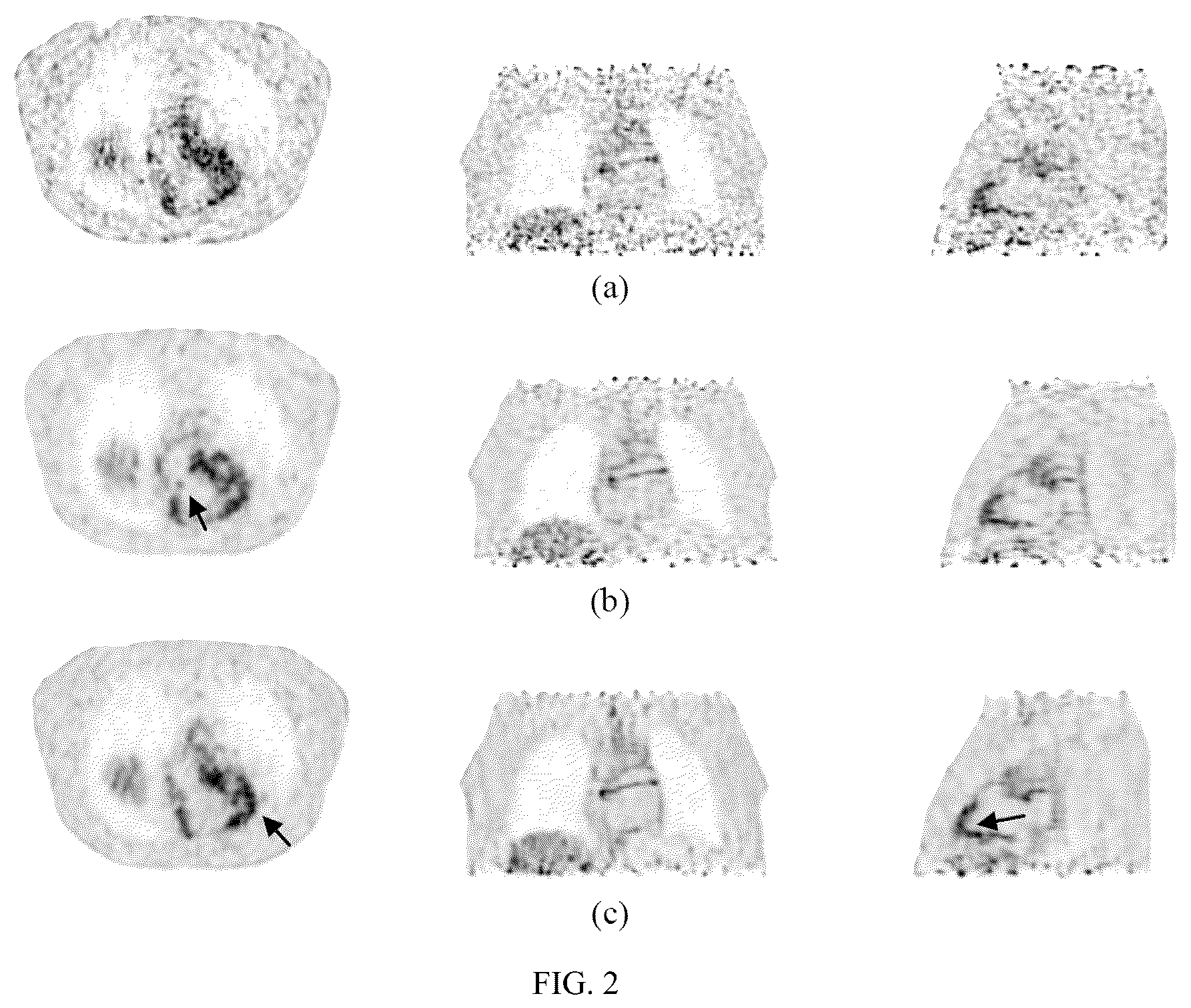 Patent US12367622 Figure 2 – Multi-task learning based regions-of-interest enhancement in PET image reconstruction