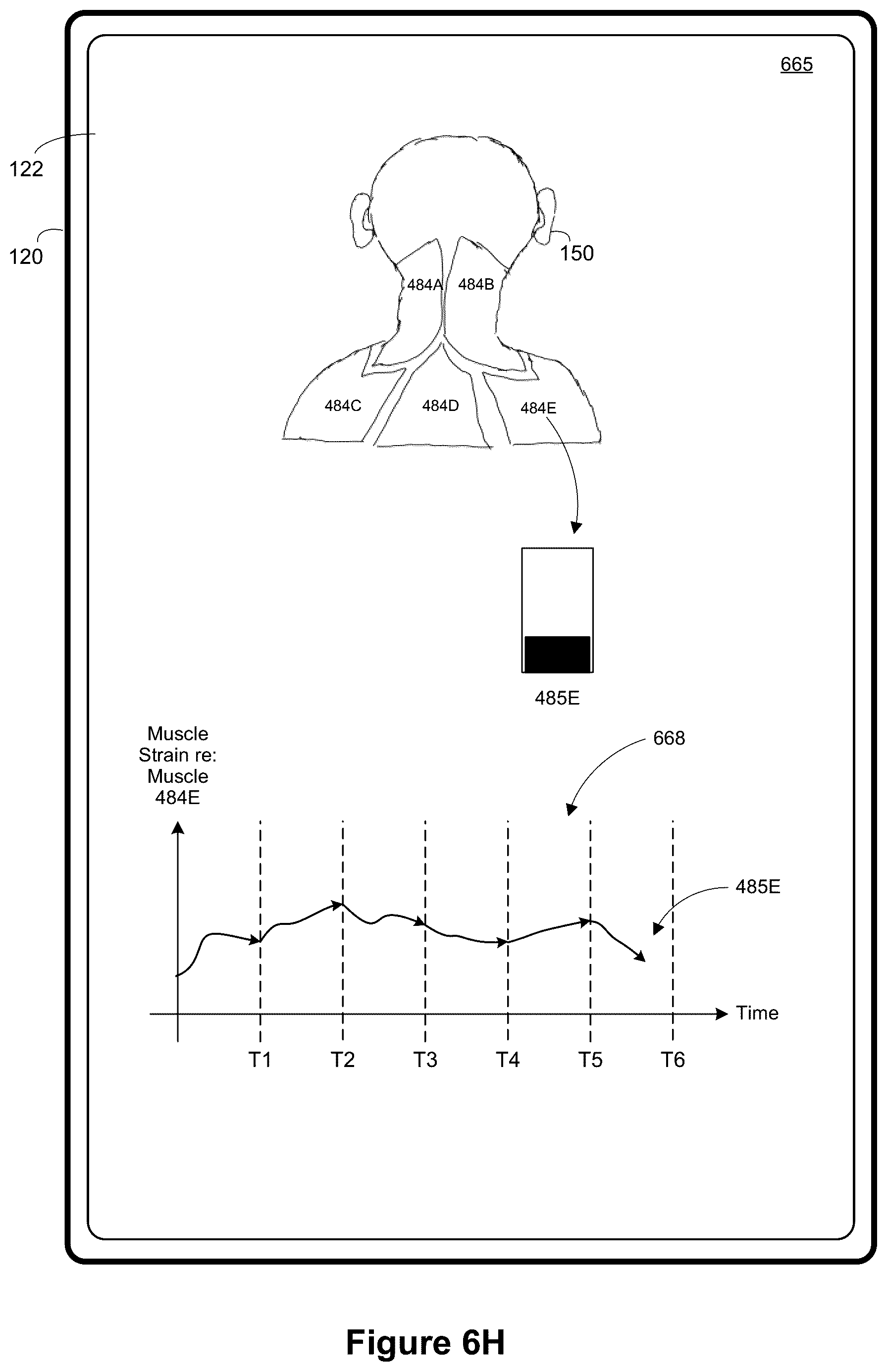Patent US12367632 Figure 14 – Method and device for surfacing accumulated strain information