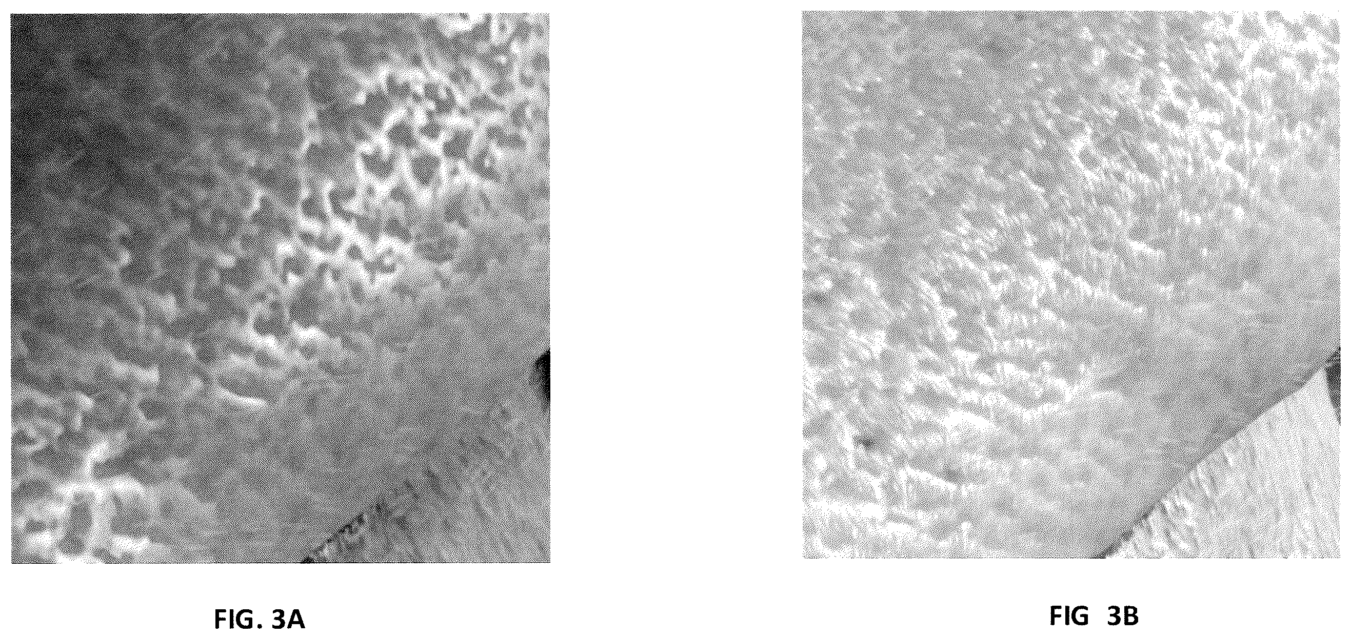 Patent US12367635 Figure 3 – Skin microstructure texture filtering for runtime facial animations
