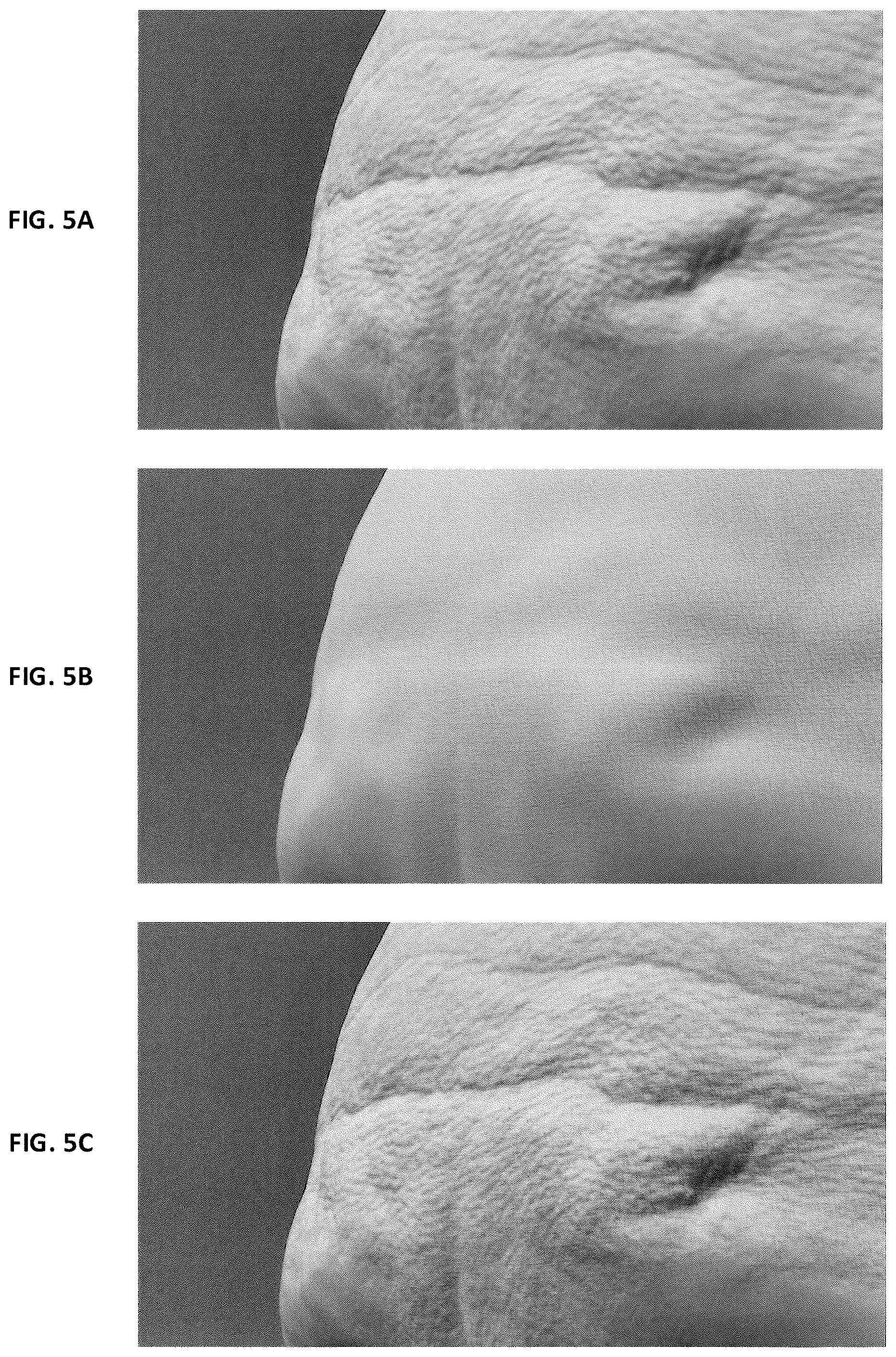 Patent US12367635 Figure 5 – Skin microstructure texture filtering for runtime facial animations