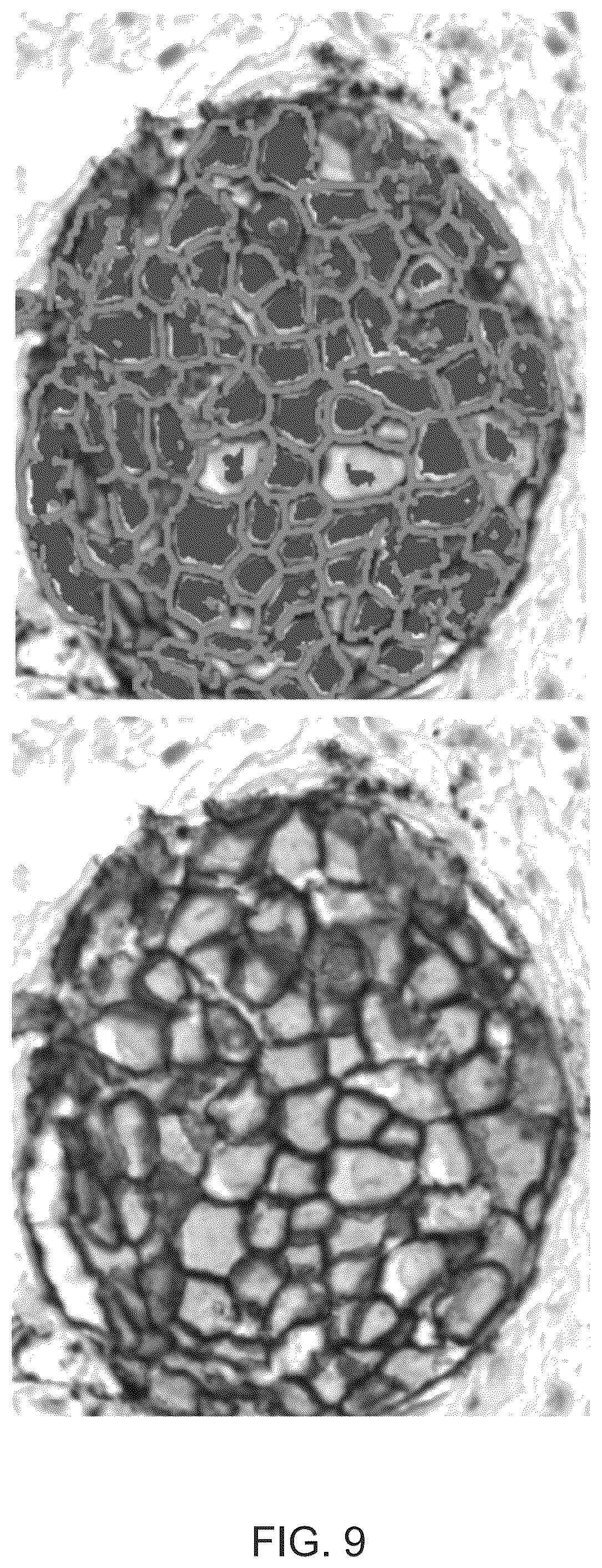 Patent US12367692 Figure 11 – Systems for automated in situ hybridization analysis