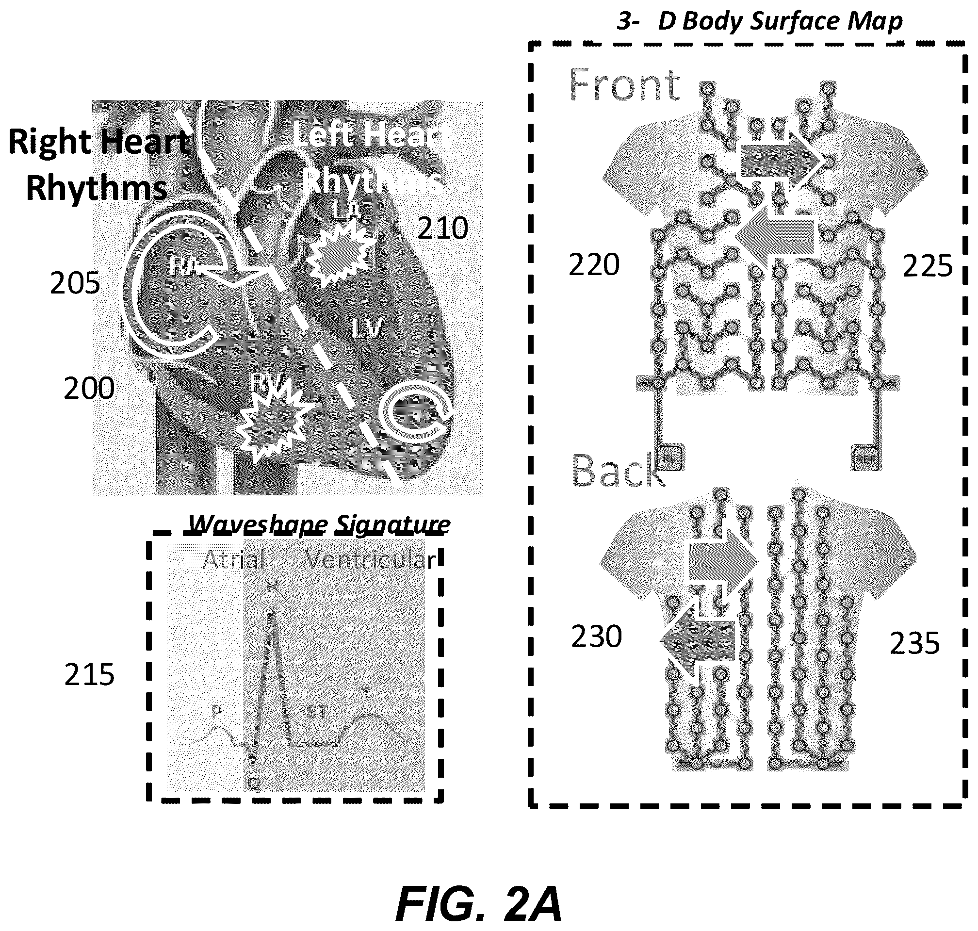 Patent US12367958 Figure 3 – Personalized heart rhythm therapy