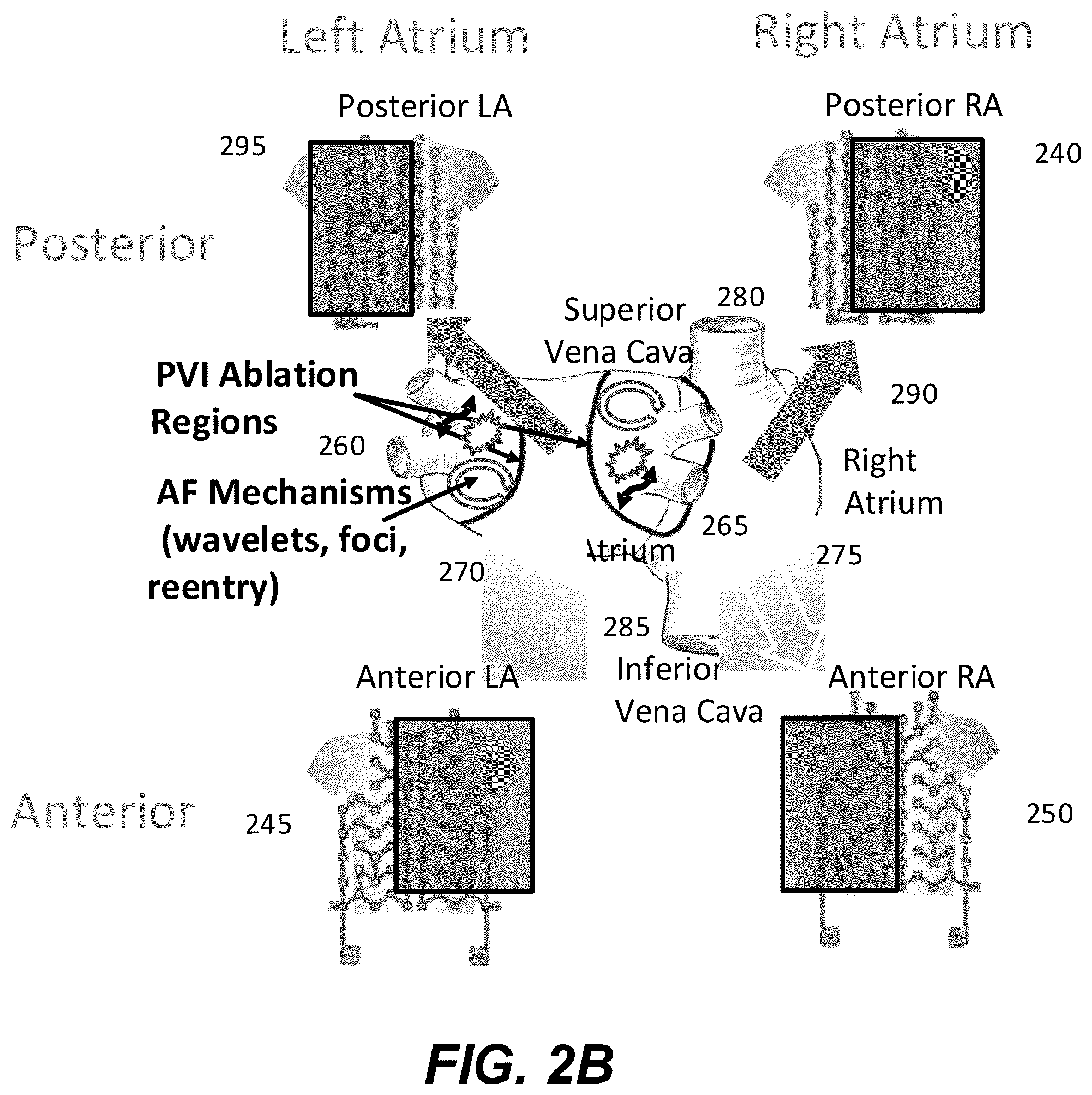 Patent US12367958 Figure 4 – Personalized heart rhythm therapy
