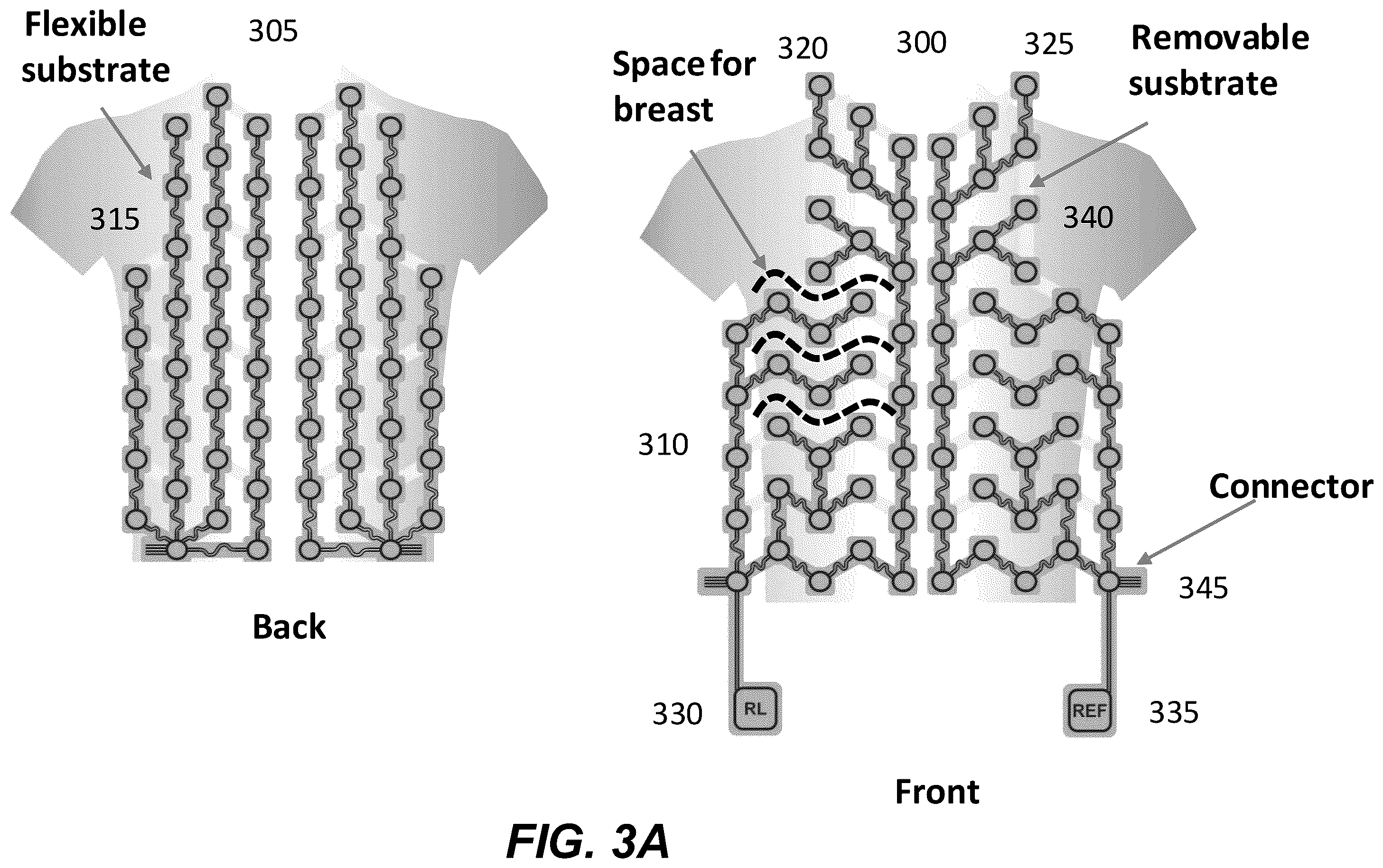 Patent US12367958 Figure 5 – Personalized heart rhythm therapy