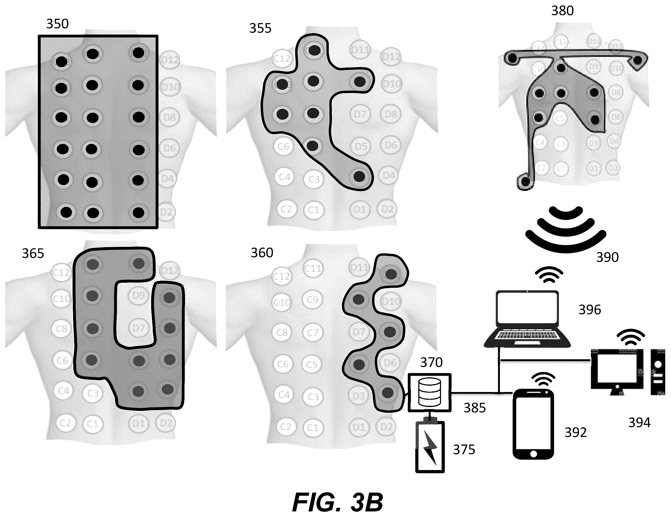 Patent US12367958 Figure 6 – Personalized heart rhythm therapy