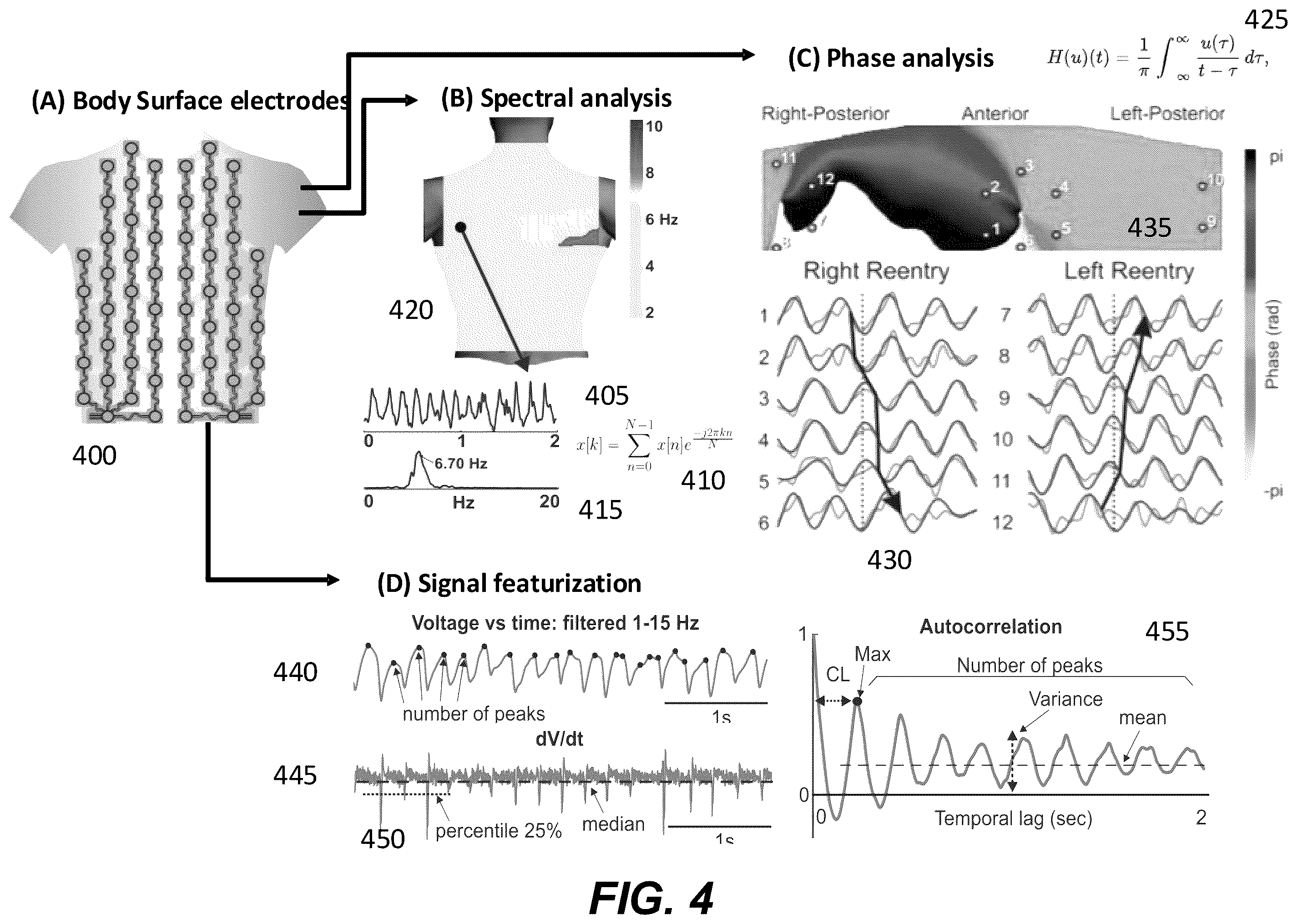 Patent US12367958 Figure 7 – Personalized heart rhythm therapy