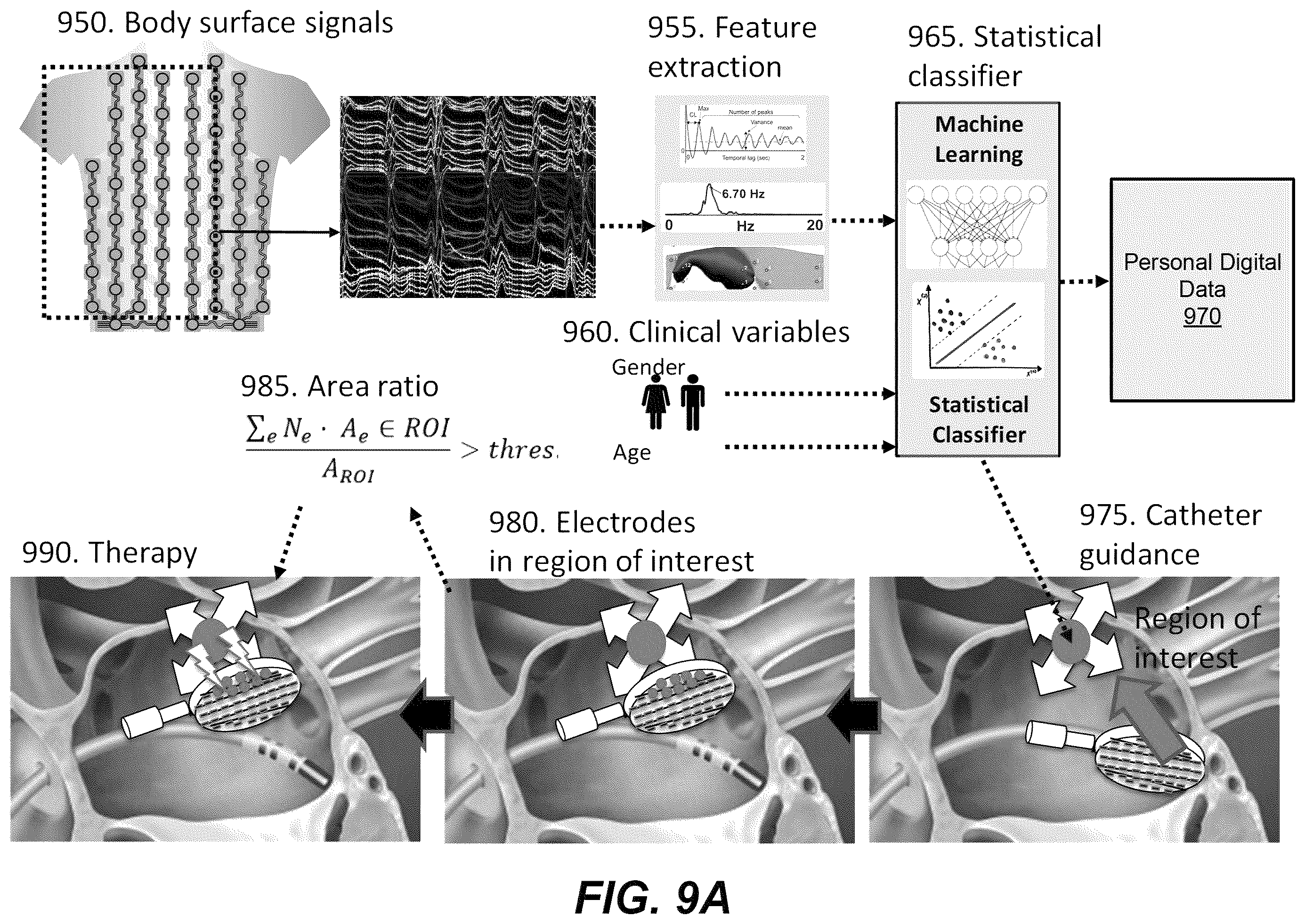 Patent US12367958 Figure 14 – Personalized heart rhythm therapy