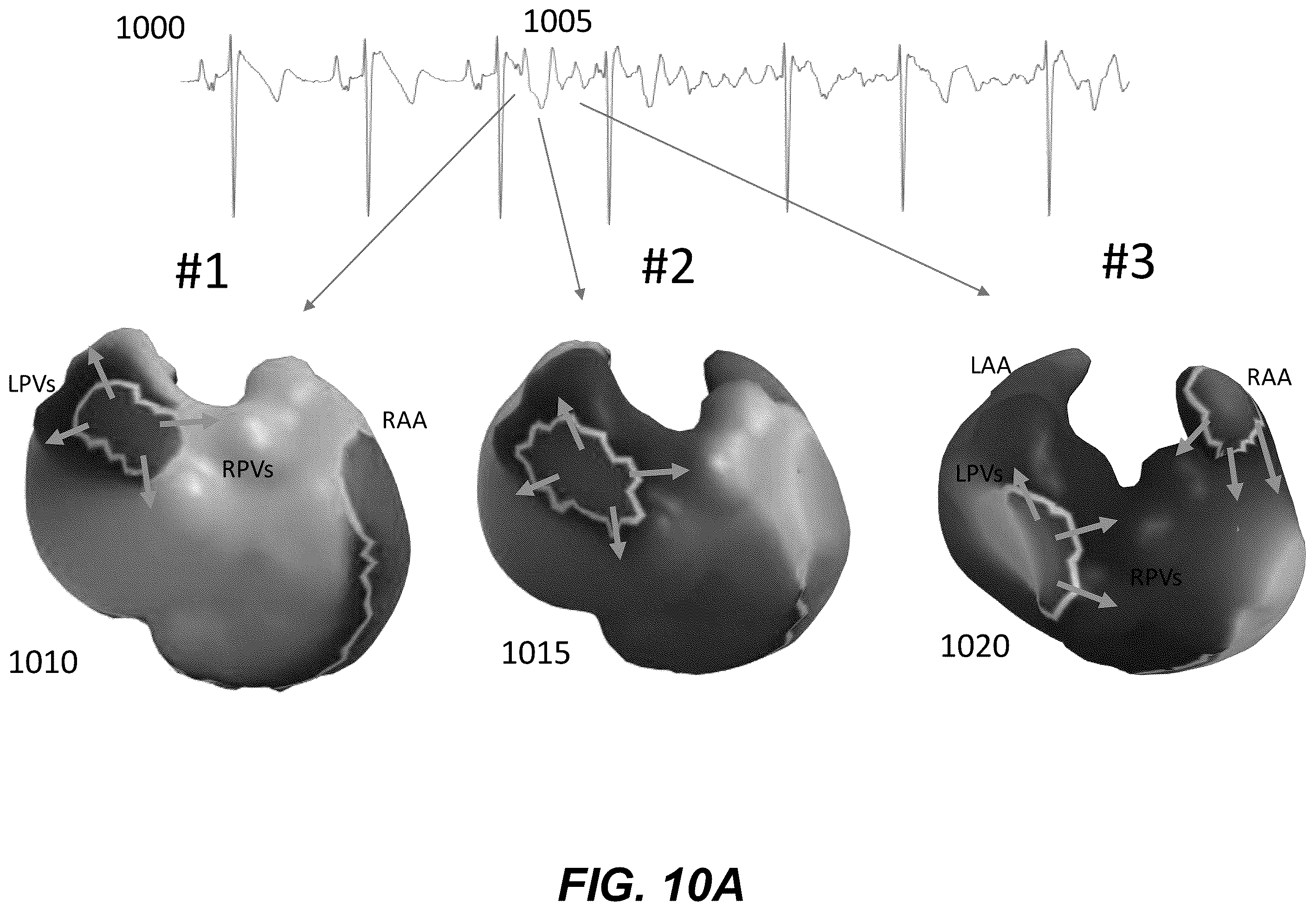 Patent US12367958 Figure 17 – Personalized heart rhythm therapy