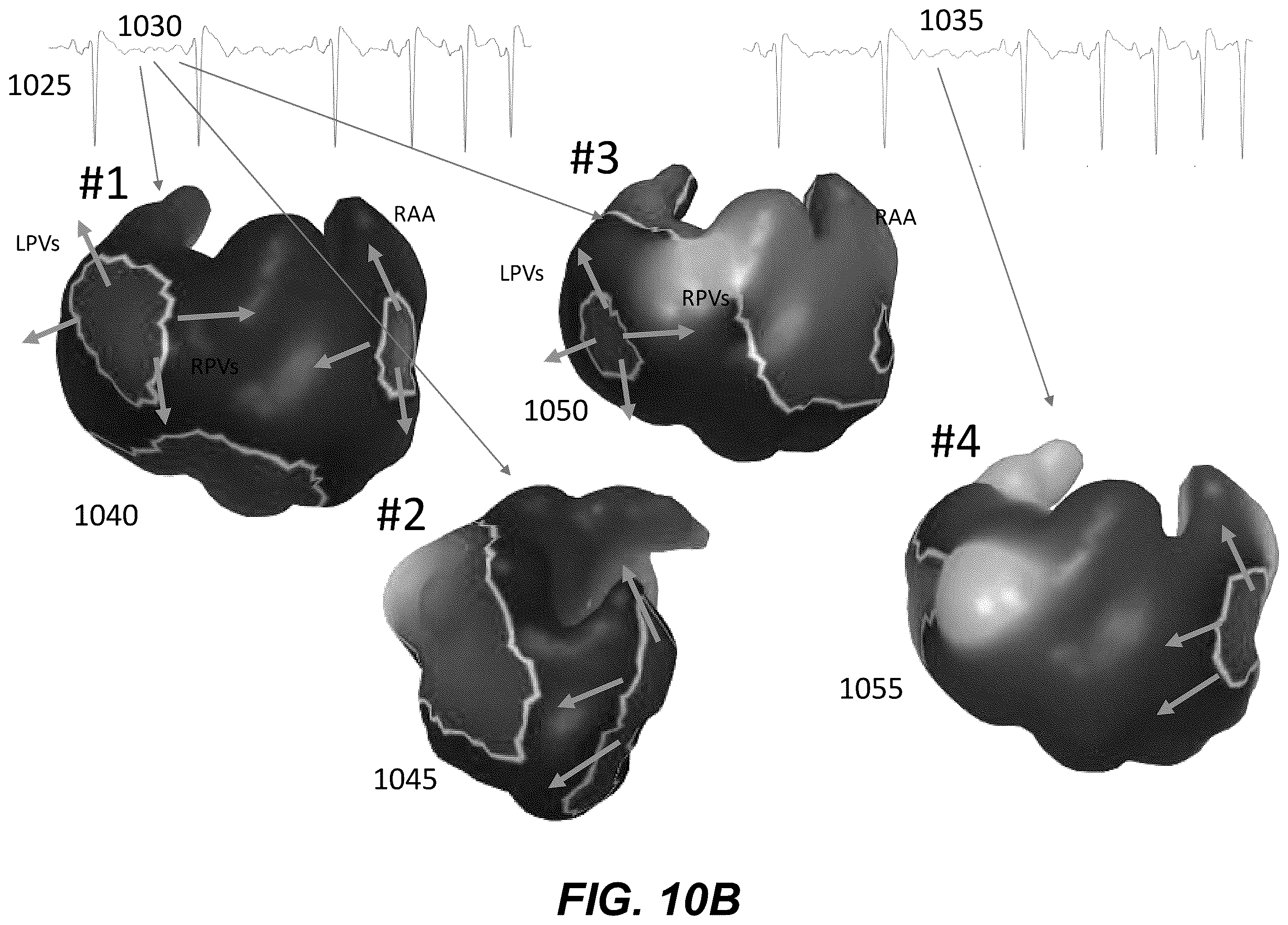 Patent US12367958 Figure 18 – Personalized heart rhythm therapy