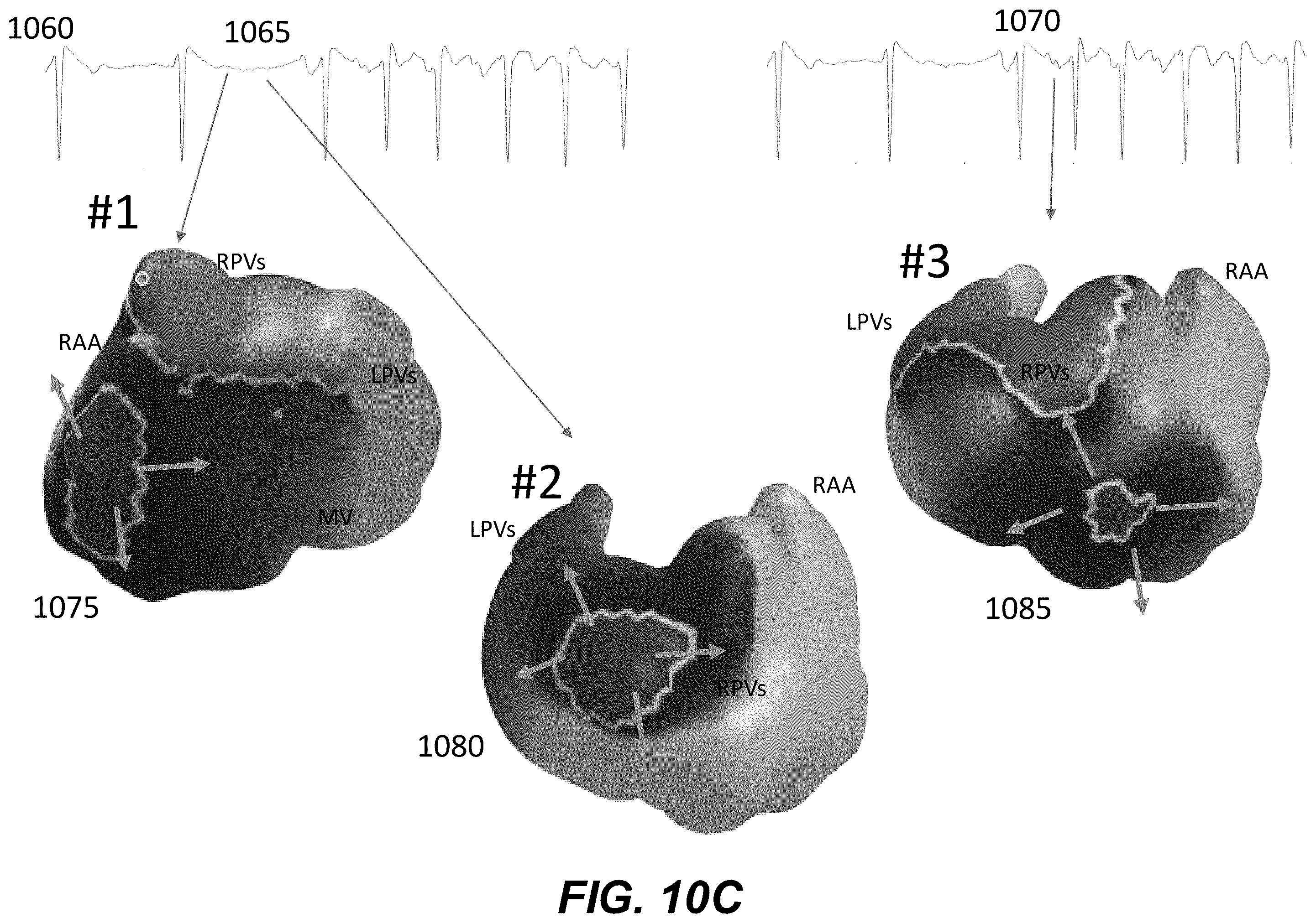 Patent US12367958 Figure 19 – Personalized heart rhythm therapy