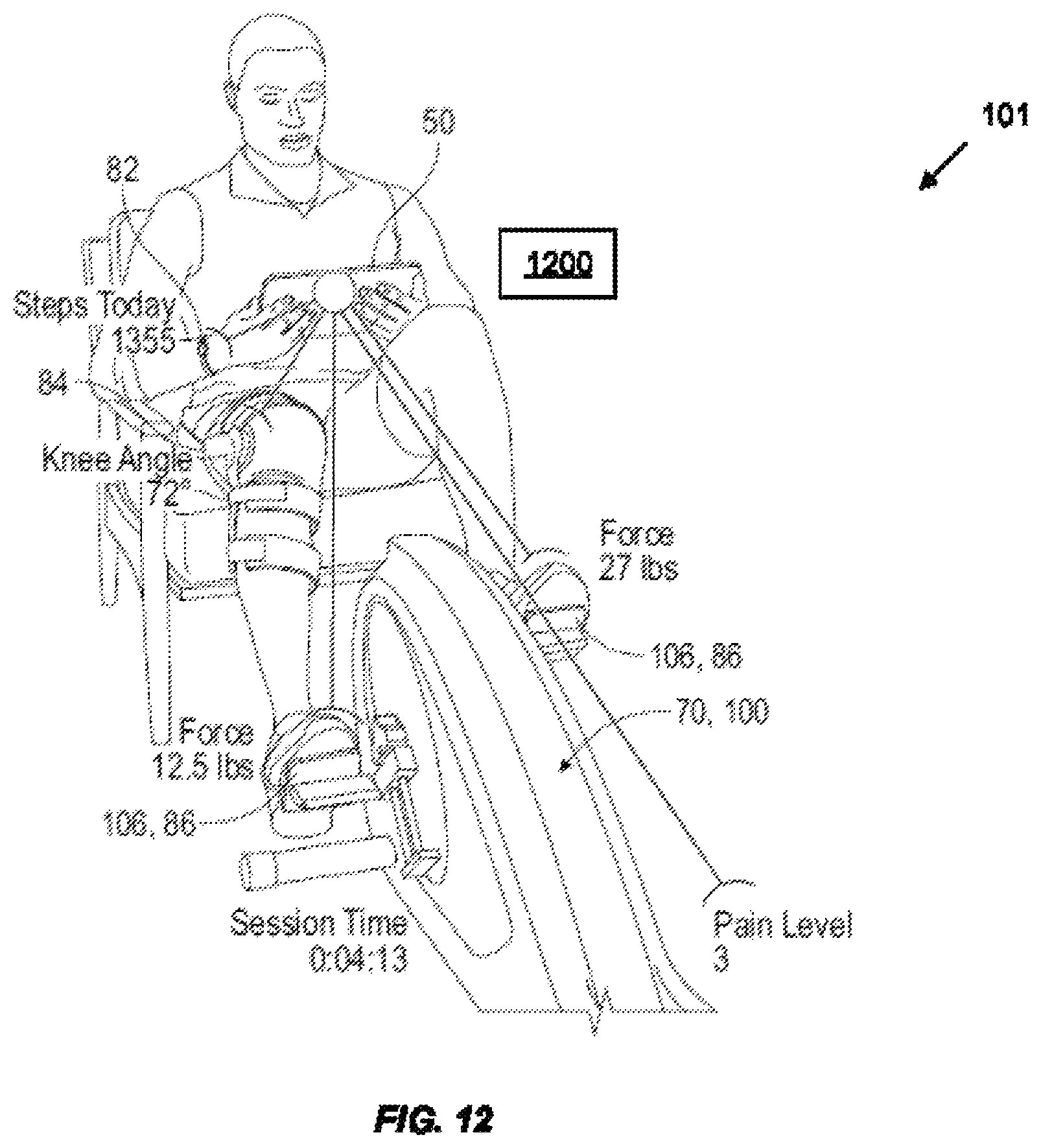 Patent US12367960 Figure 11 – System and method for using AI ML and telemedicine to perform bariatric rehabilitation via an electromechanical machine