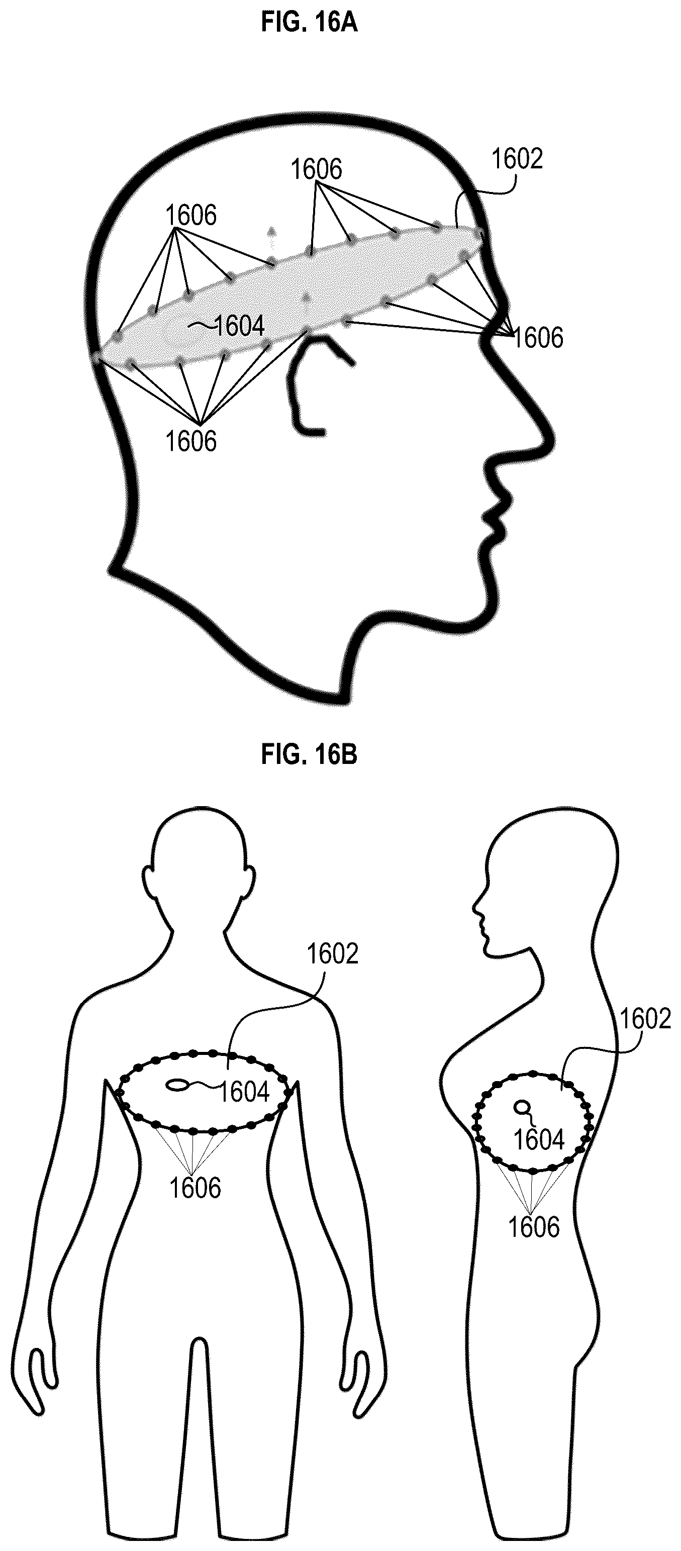 Patent US12367961 Figure 16 – Methods, systems, and apparatuses for fast approximation of electric field distribution